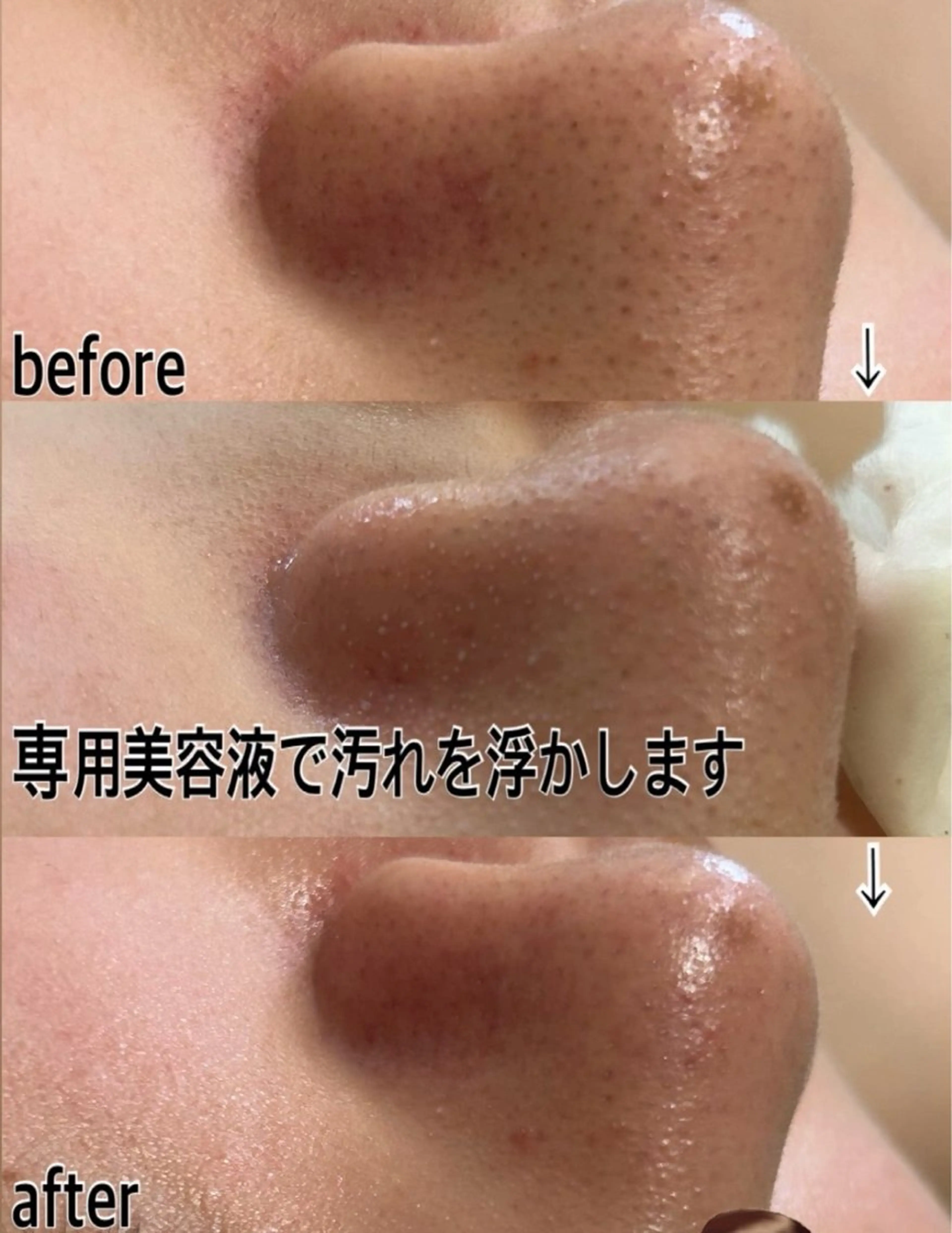 aroma  YURARI所属・韓国艶美人// 毛穴ケア🌹のエステ・リラクイメージ