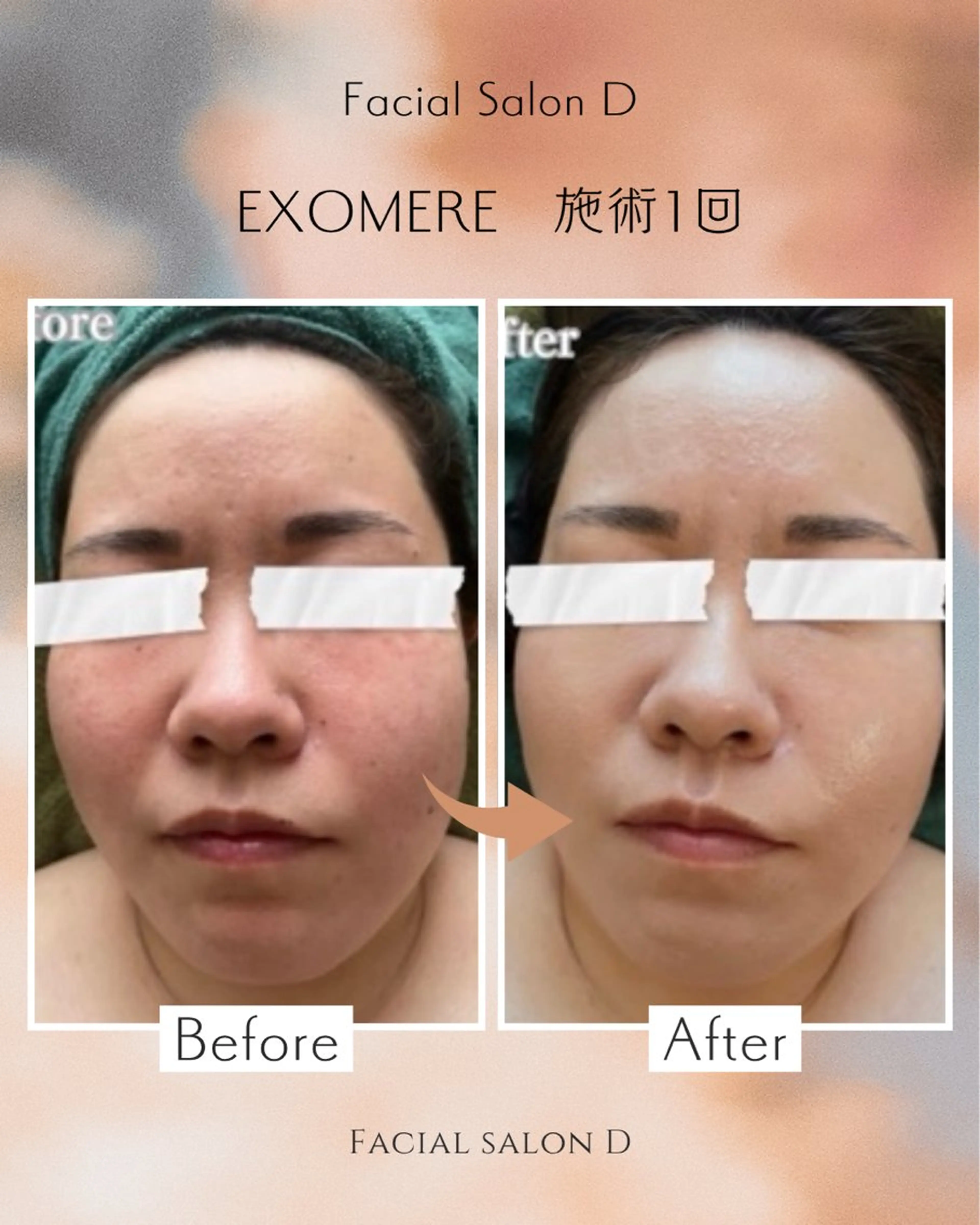 エステ リラク 【Salon D】 HALUのエステ・リラクイメージ