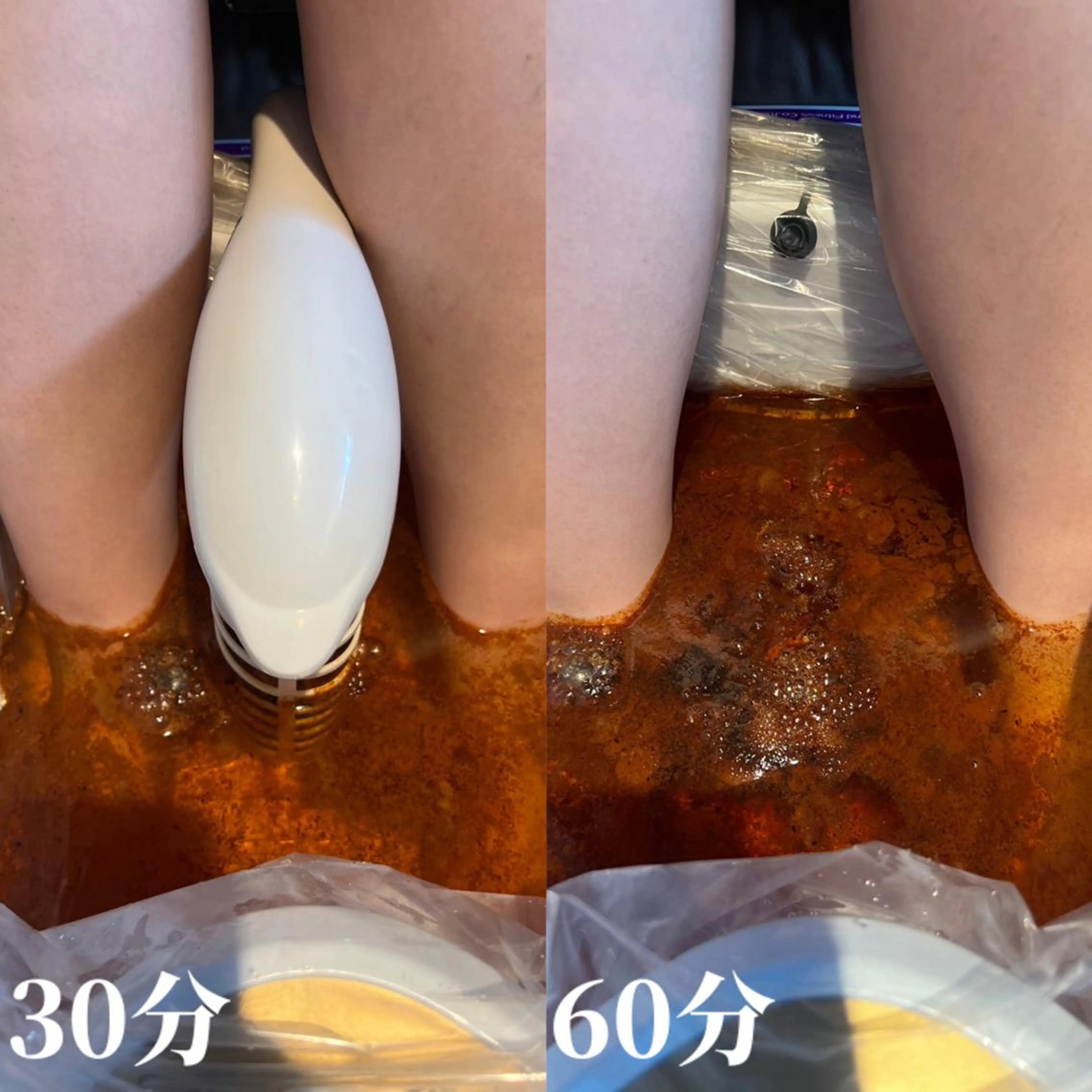 【人気No1】高濃度水素足浴(ゴッドクリーナー)60分 7000円の写真