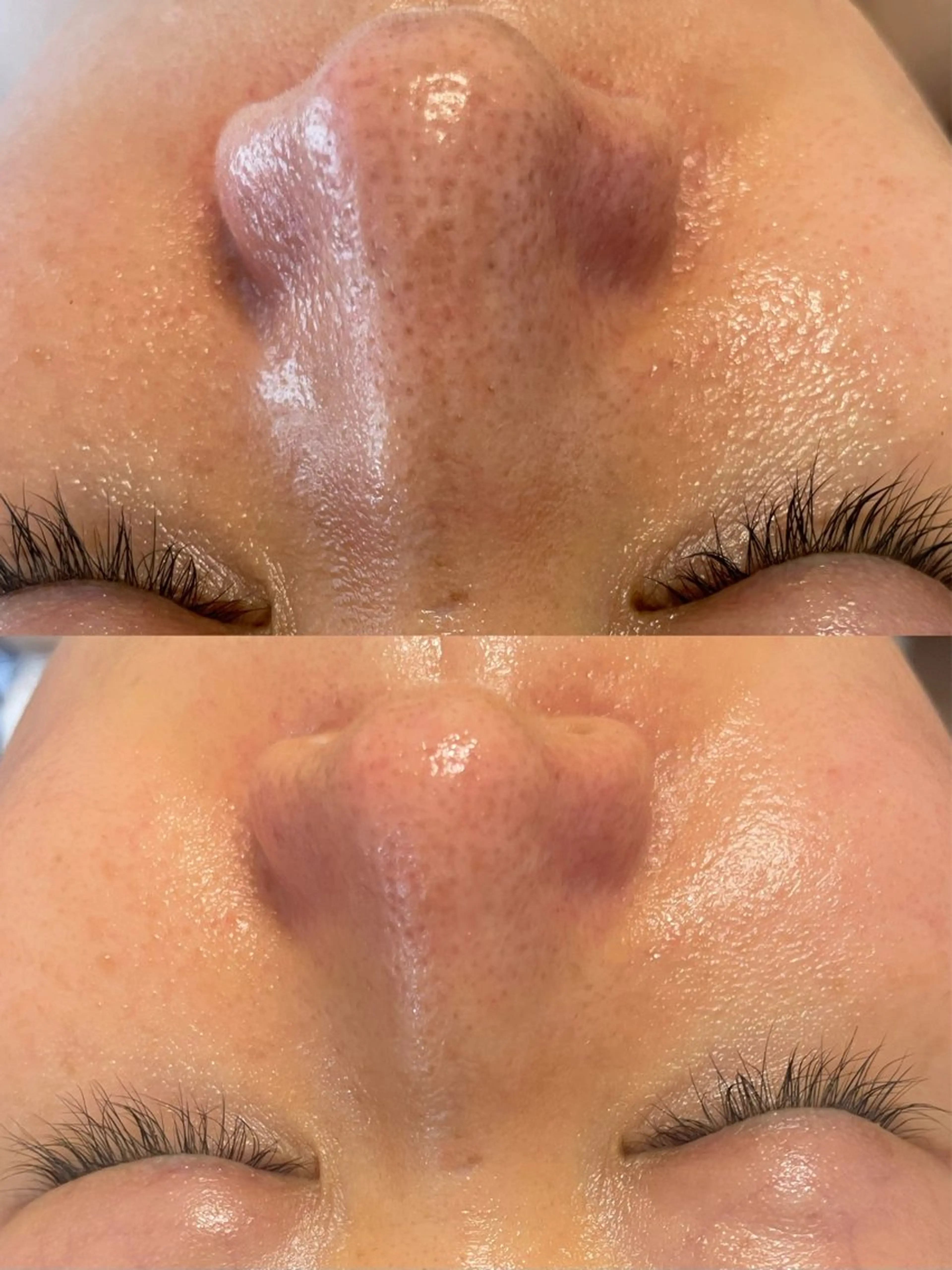 西区九条エステ MITUREIサロンのエステ・リラクイメージ