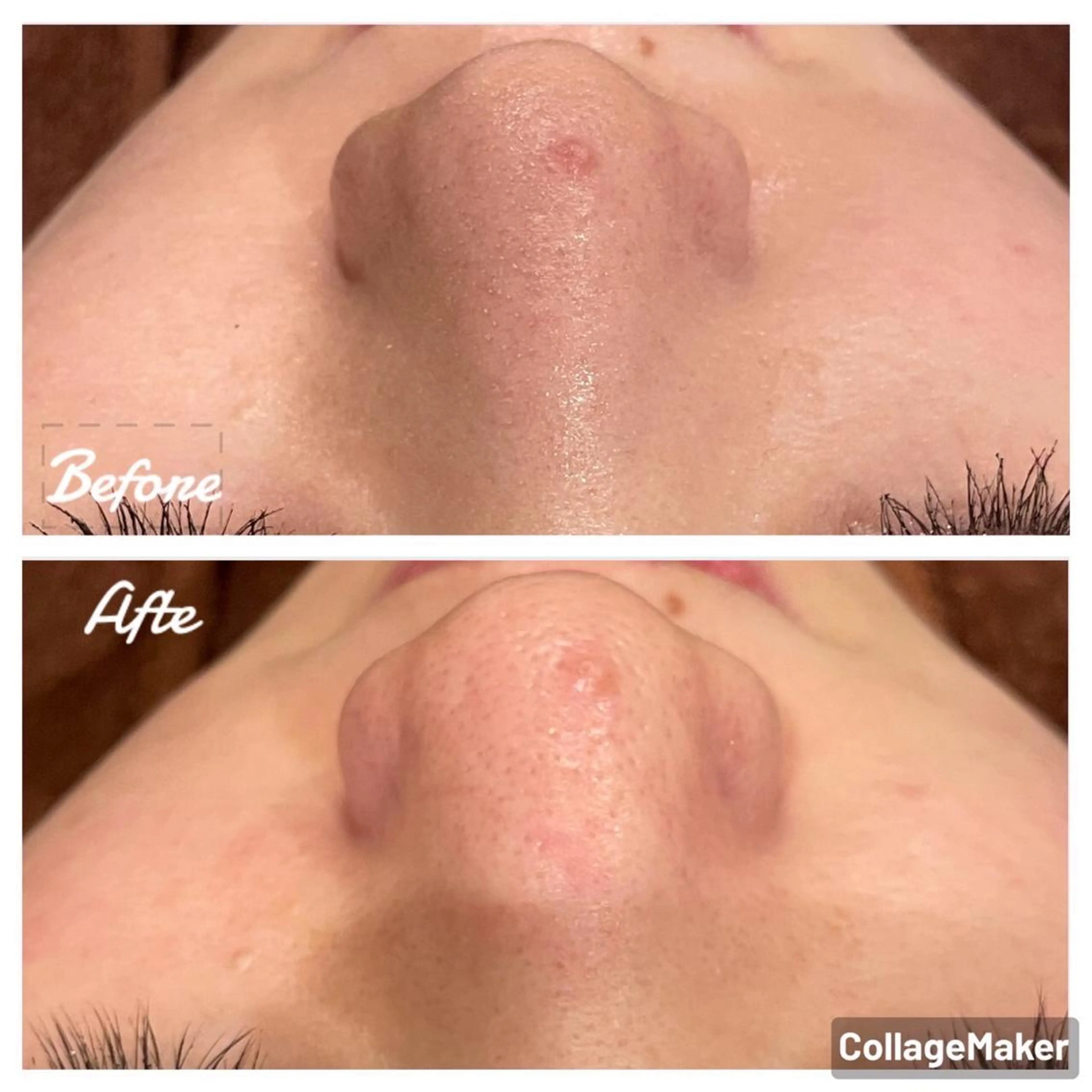 脱毛 ULULU上野店所属・ULULU 上野店のエステ・リラクイメージ