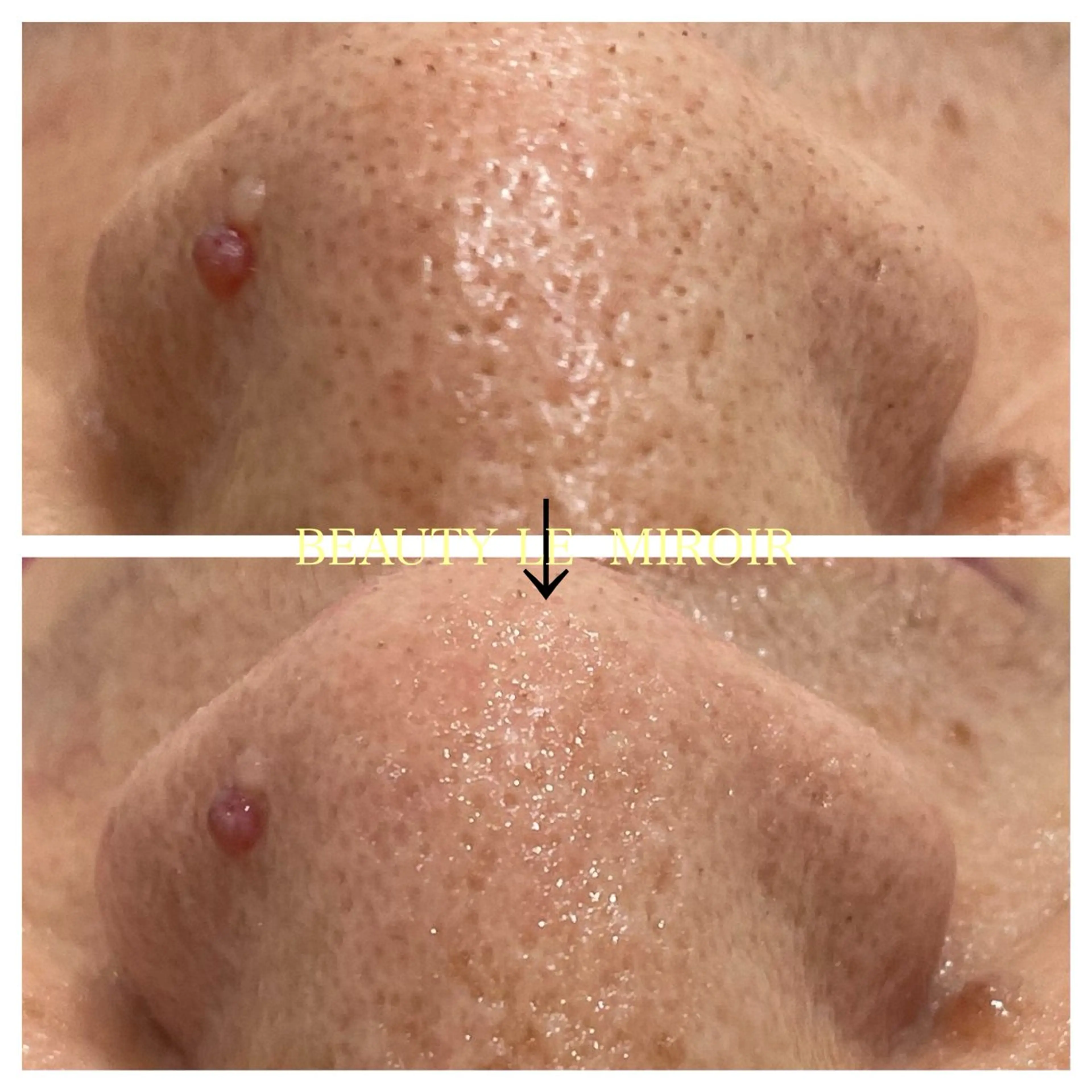 エステ ビューティー ミロワールのエステ・リラクイメージ