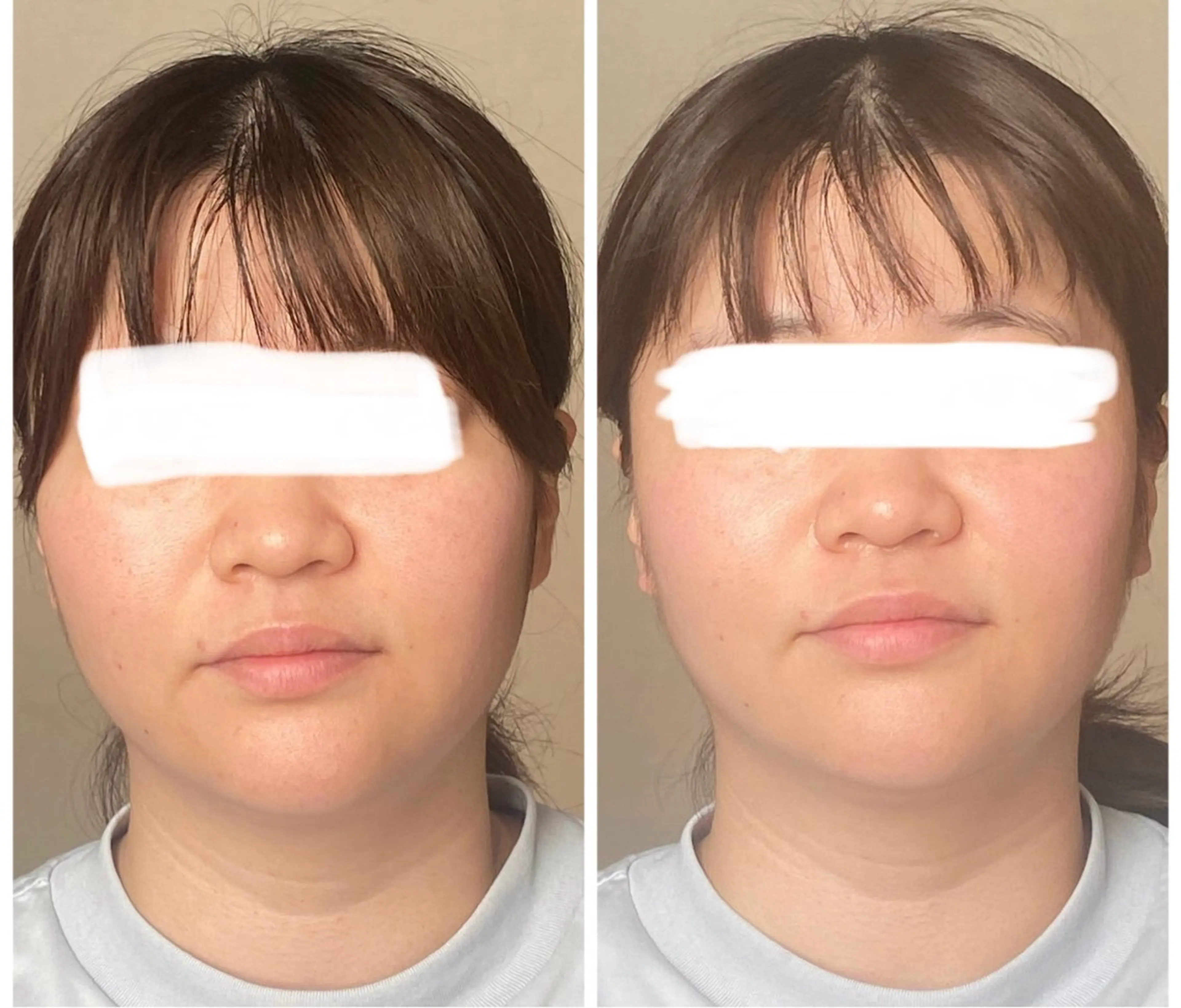 美骨エステサロン LuxAのエステ・リラクイメージ