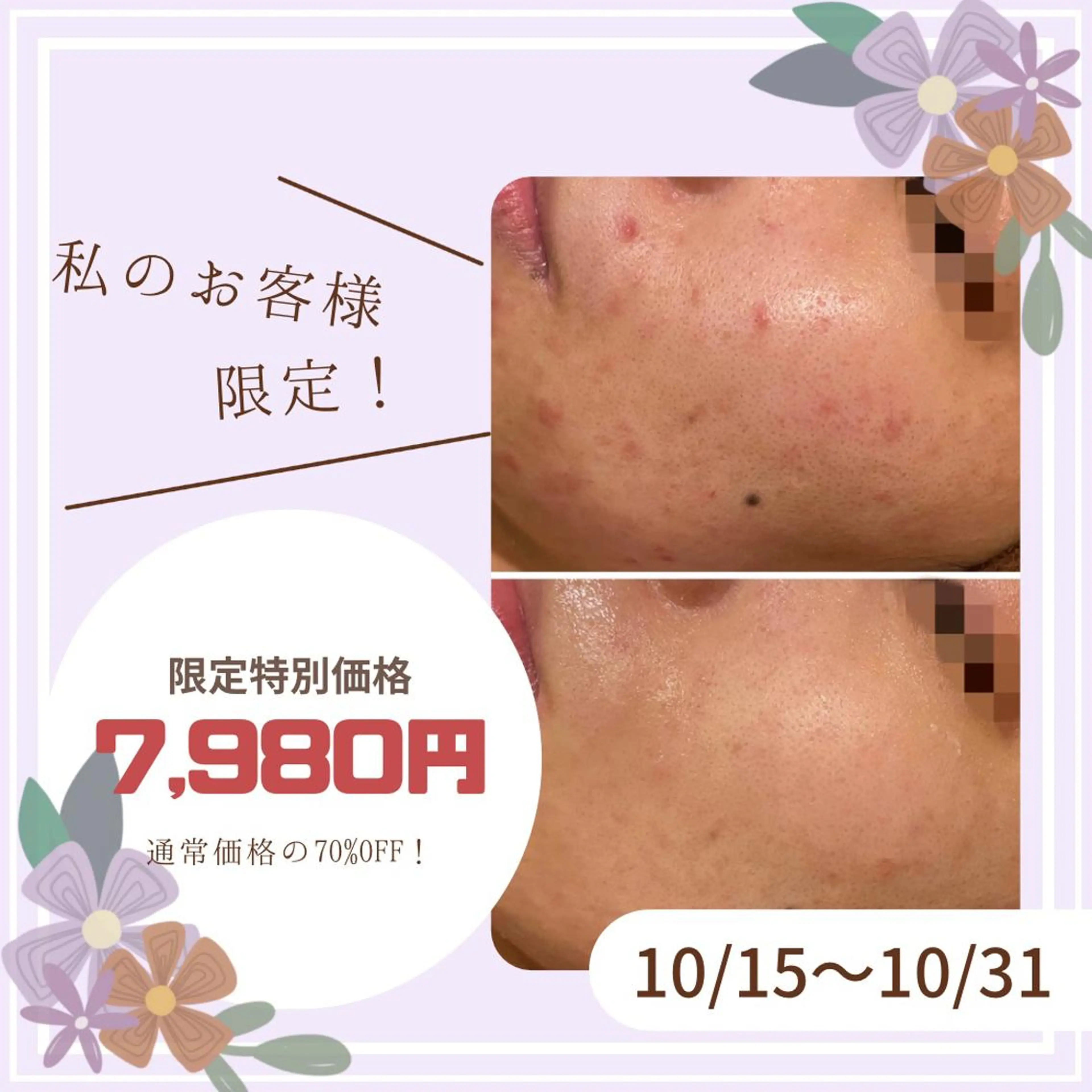 セミロング カラー パーマ ヘアアレンジ メンズ キッズ ネイル マツエク・マツパ アイブロウ ニキビ特化型エステ 🍓最短で肌質改善のエステ・リラクイメージ