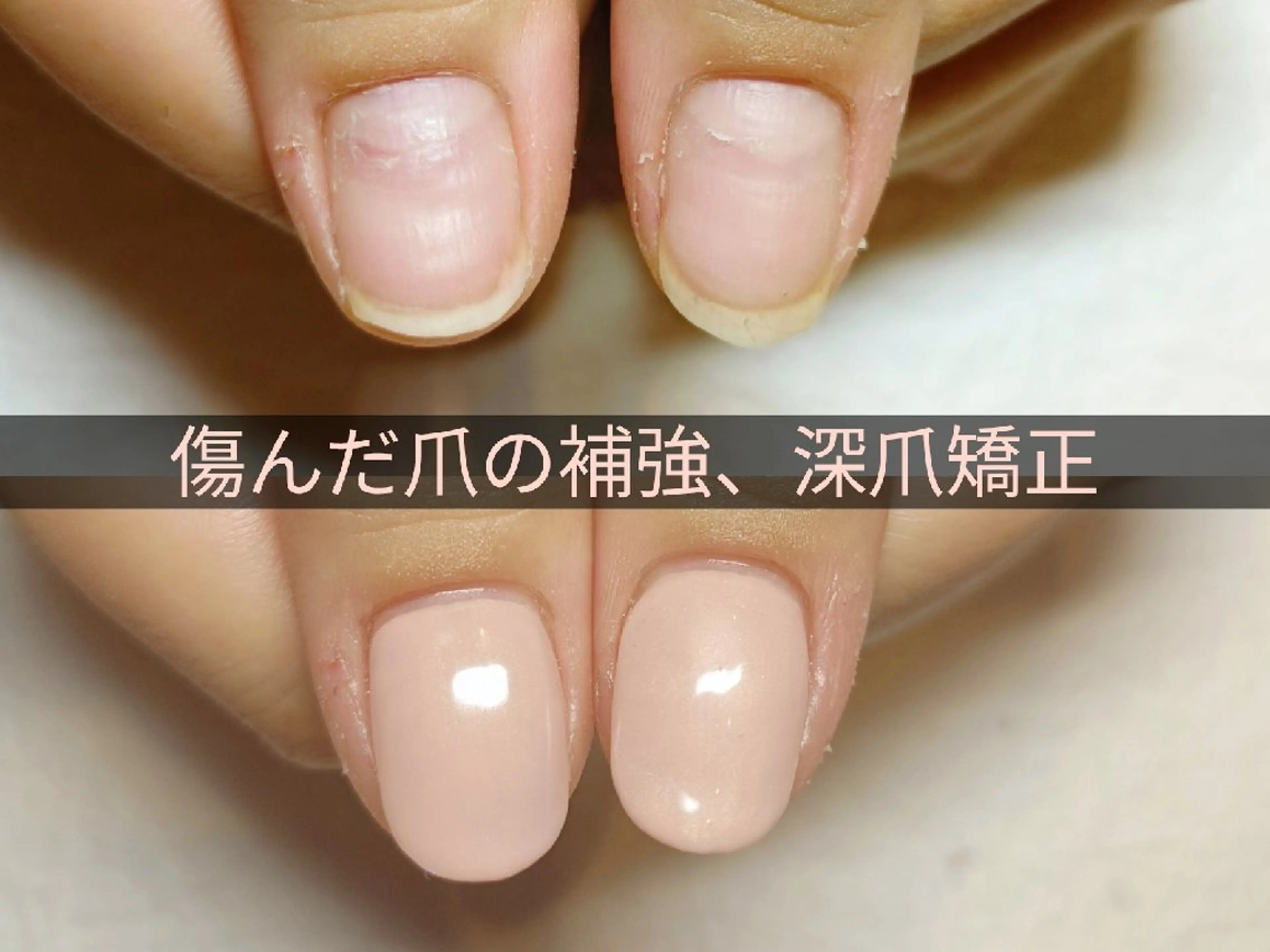 ネイル ハンドネイル ハンドケア 深爪矯正/爪育成ケア manie nailのネイルデザイン