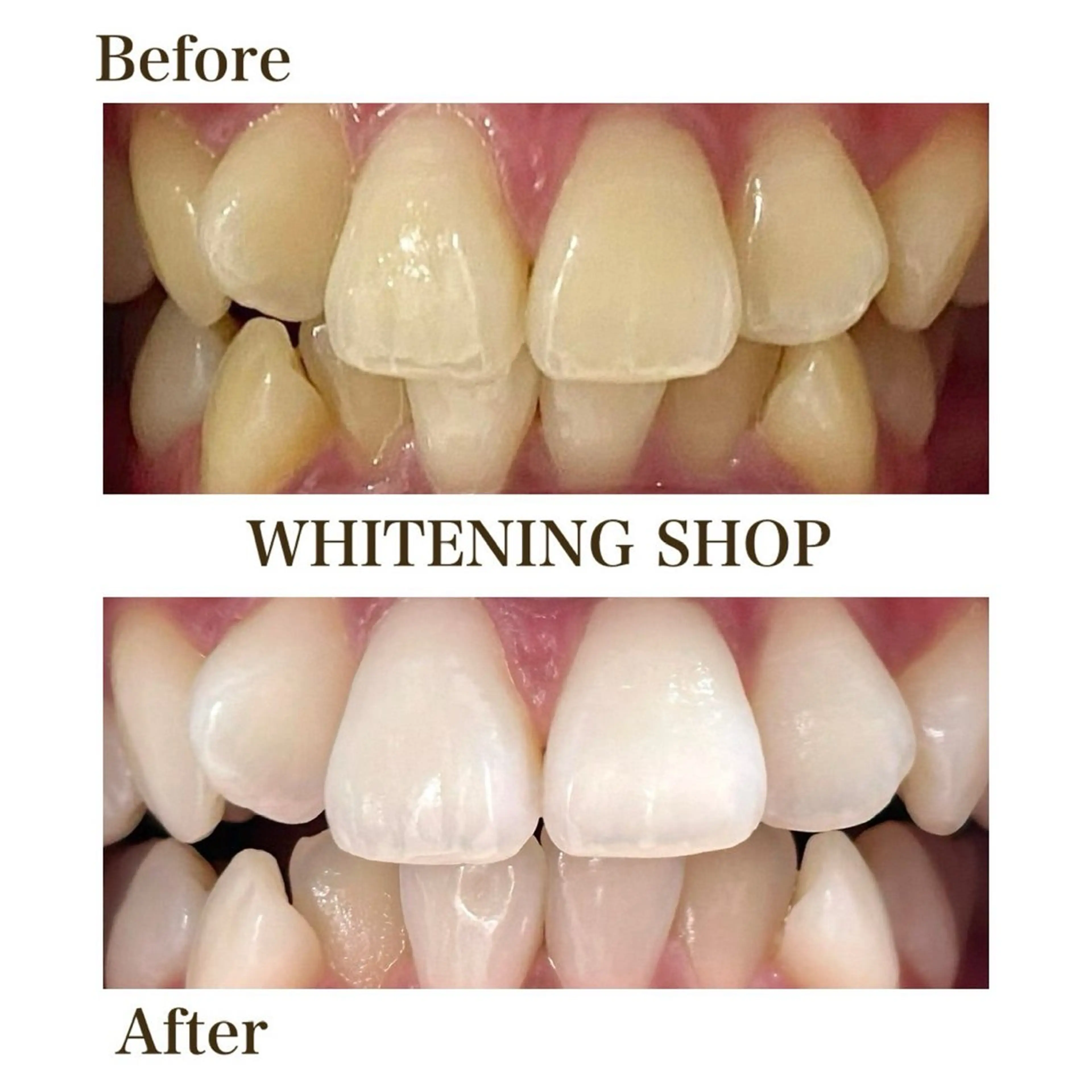 その他 ホワイトニングショップ静岡葵区店所属・ホワイトニング ショップ葵区静岡駅店のその他イメージ