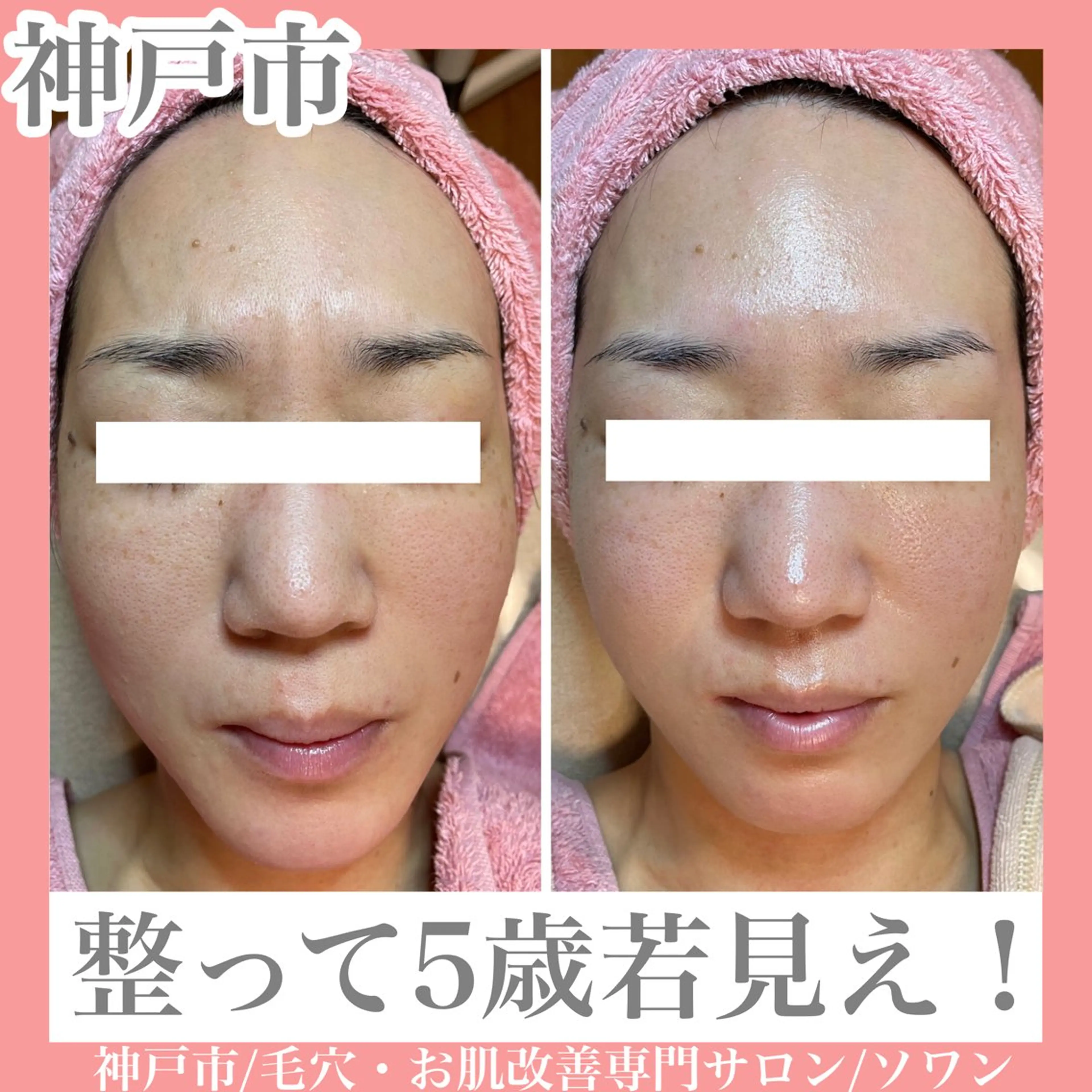 お肌改善コースの写真