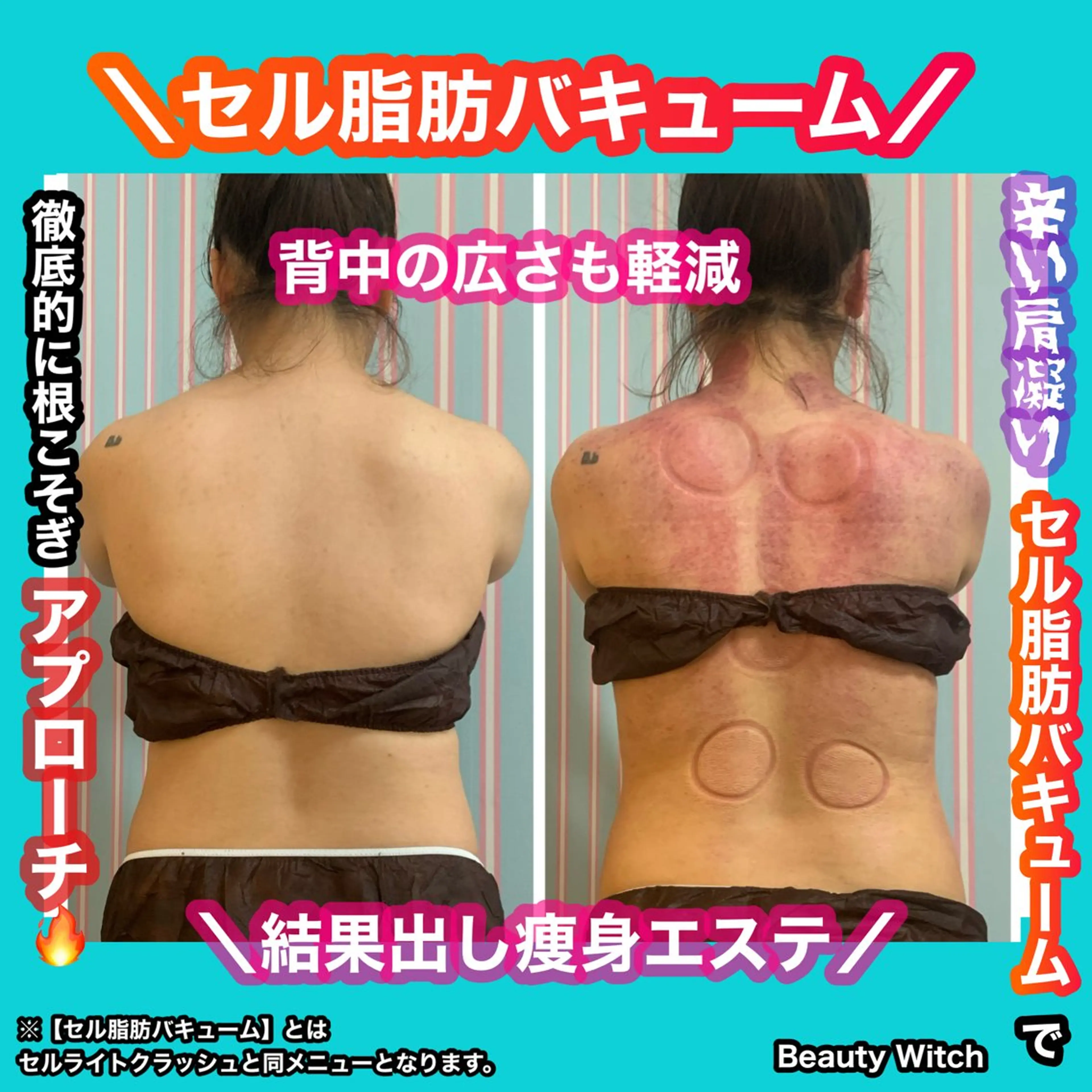 エステ 痩身/脱毛/ネイル HARUKAのエステ・リラクイメージ