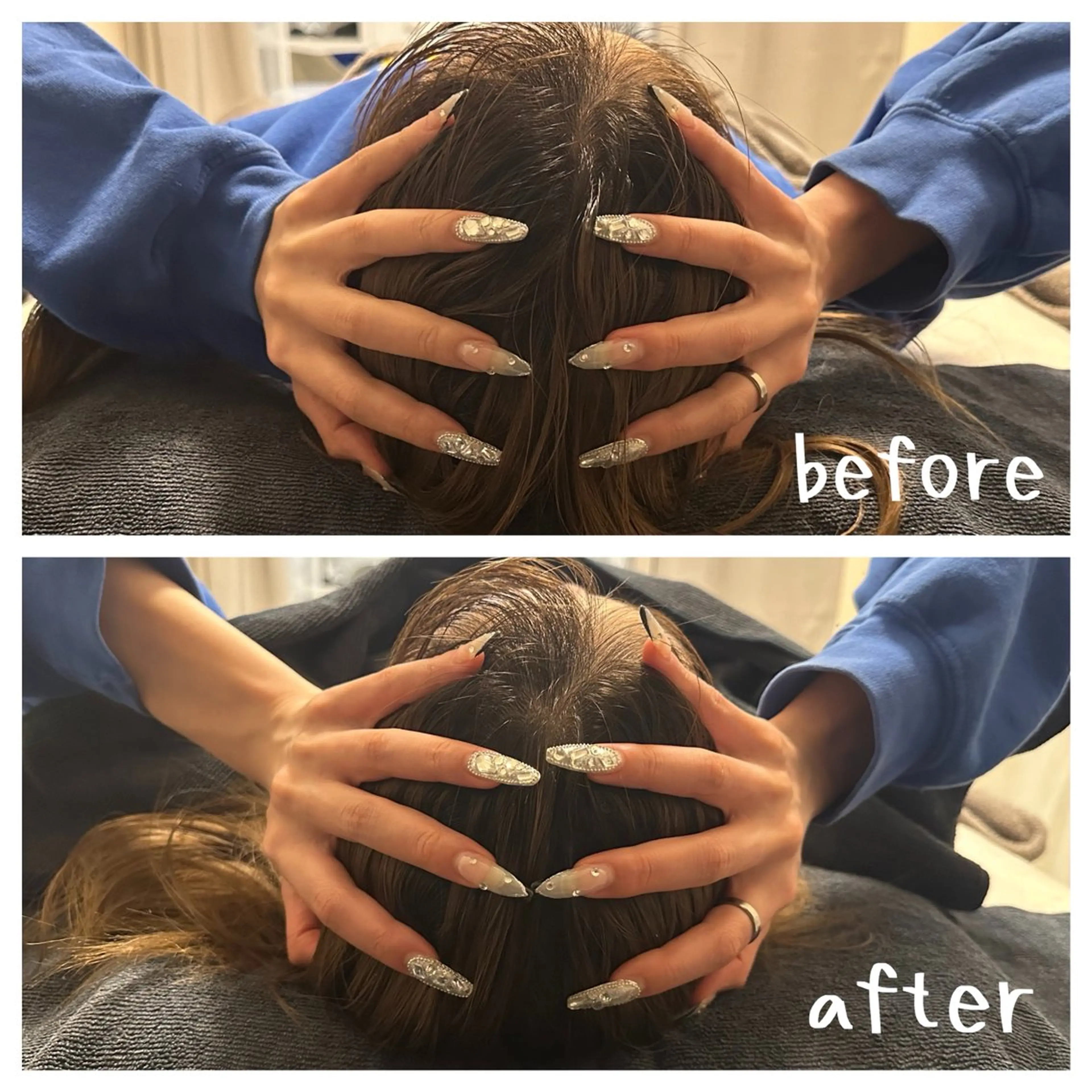 医療提携×美容整体 小顔ハイフピーリングのエステ・リラクイメージ