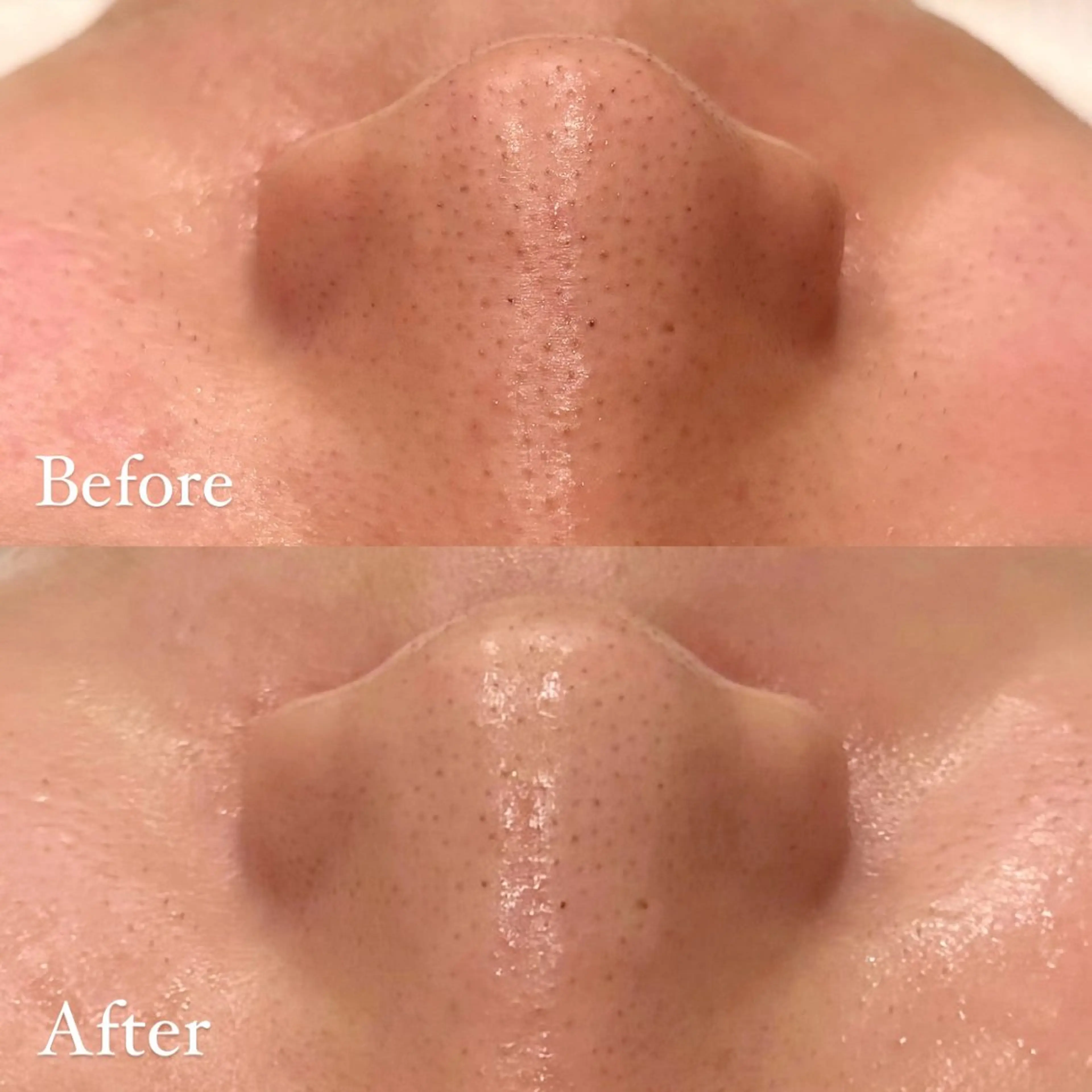 Hari Lounge恵比寿所属・chika🦋 ハリラウンジ恵比寿のエステ・リラクイメージ