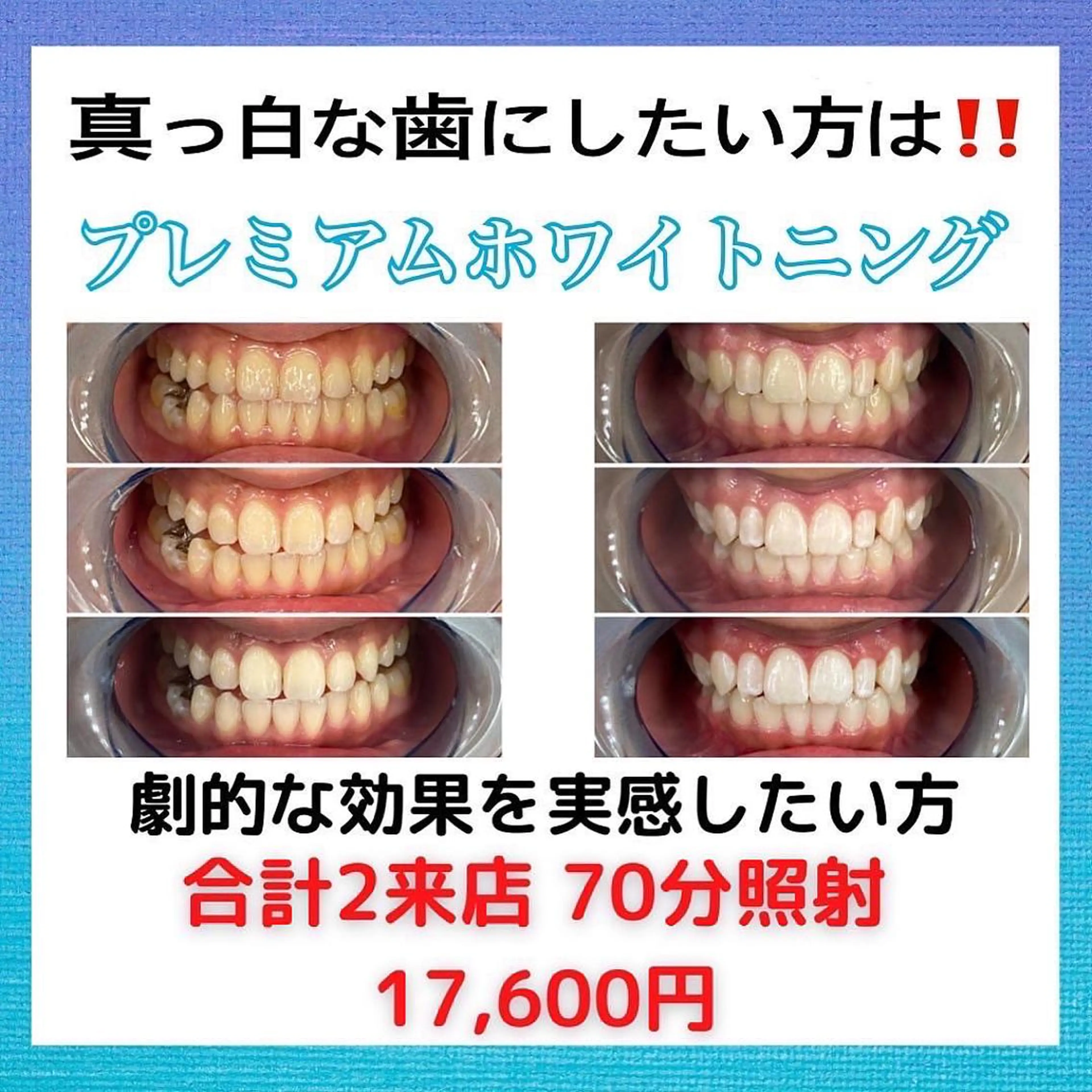 Platinum Beauty 四条烏丸店所属・吉田亮利 ホワイトニング専門店のその他イメージ