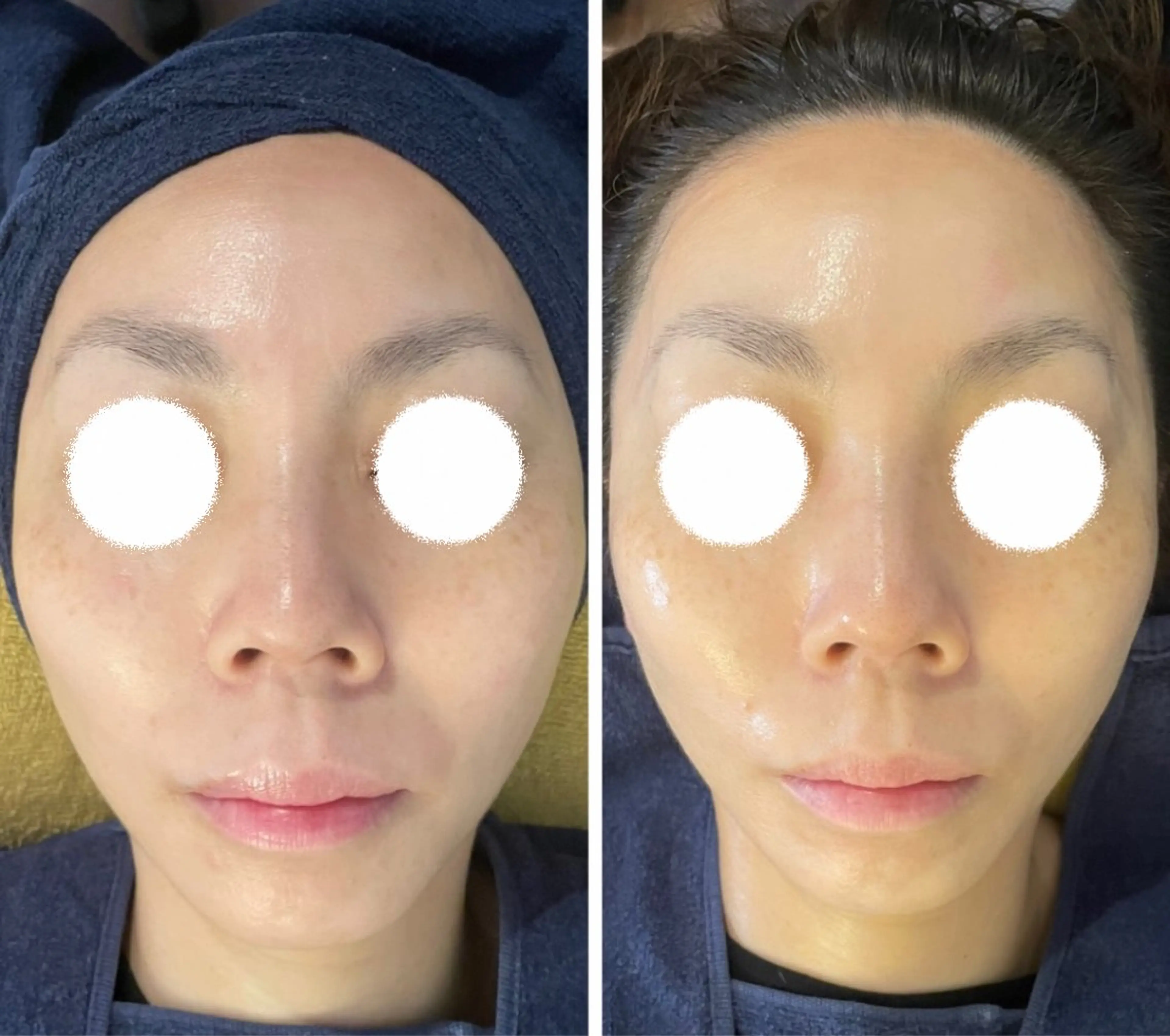 その他 耳ツボ/体質改善/ 温活La mer月島のその他イメージ