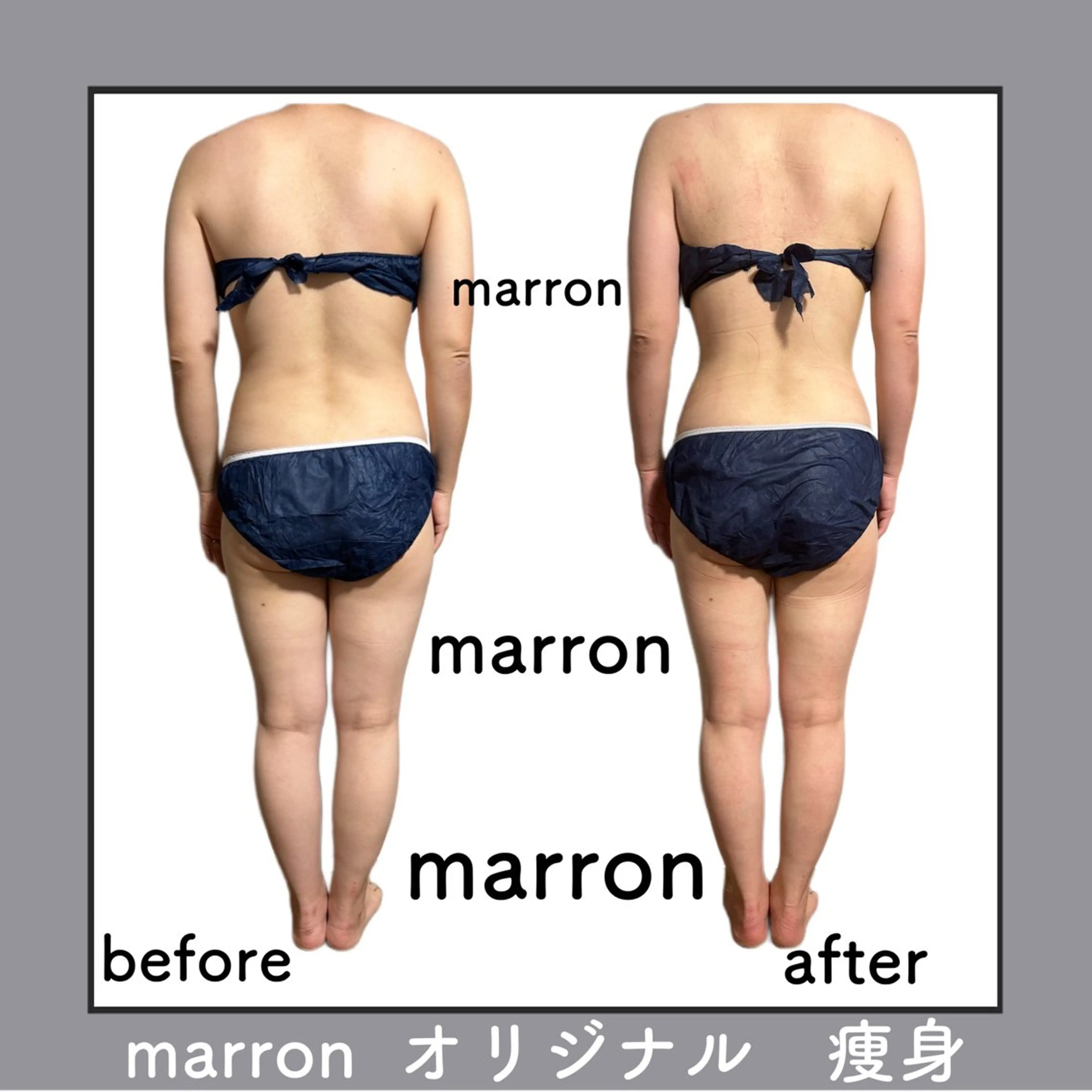 marron所属・痩身ハイパーナイフ ララピールリアボーテのエステ・リラクイメージ