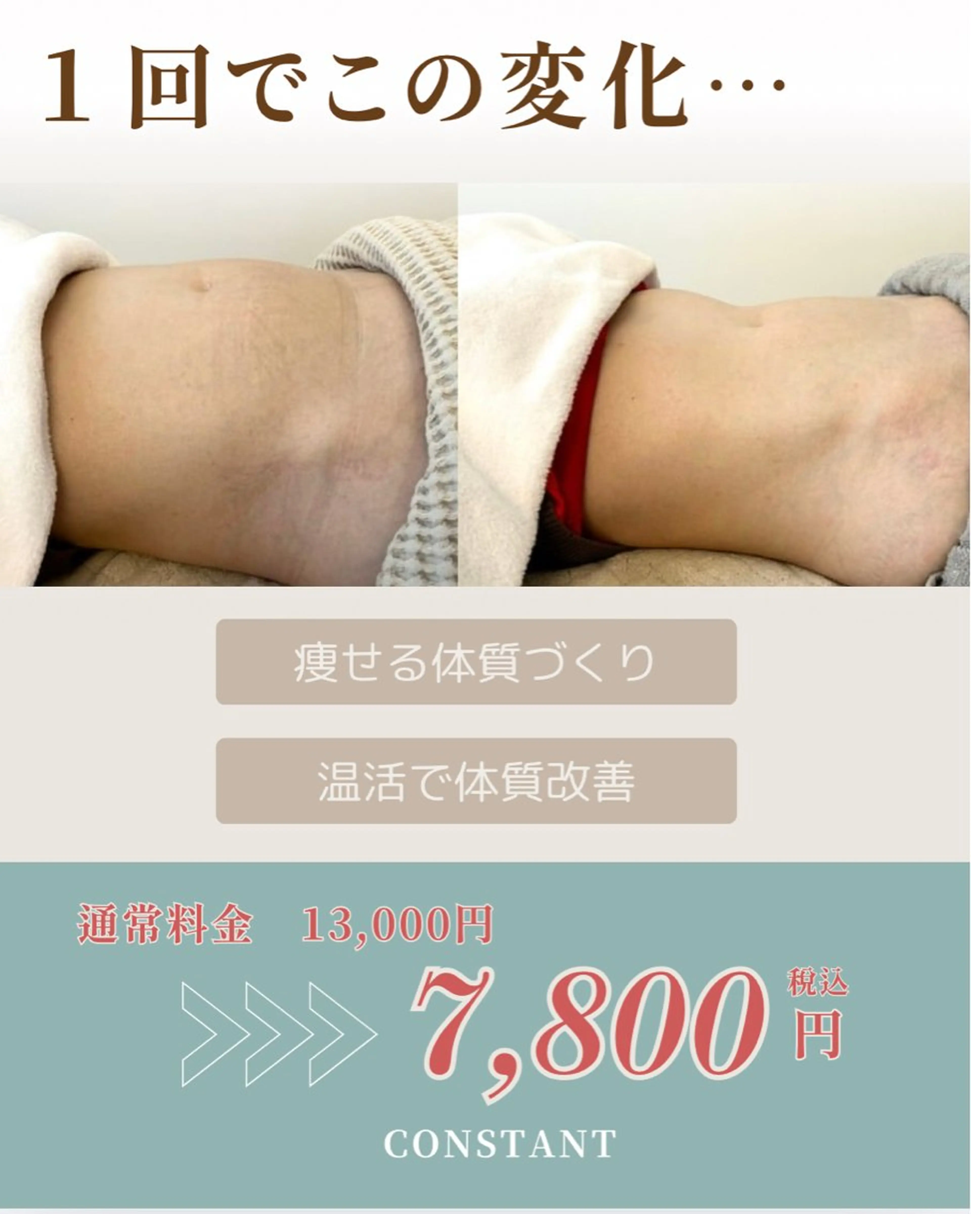クビレ革命✨【よもぎ蒸し＋腸もみ&ヘッド付】感動レベルの体感🌿発汗×高技術でクビレをつくる＋極上リラックス☁️の写真