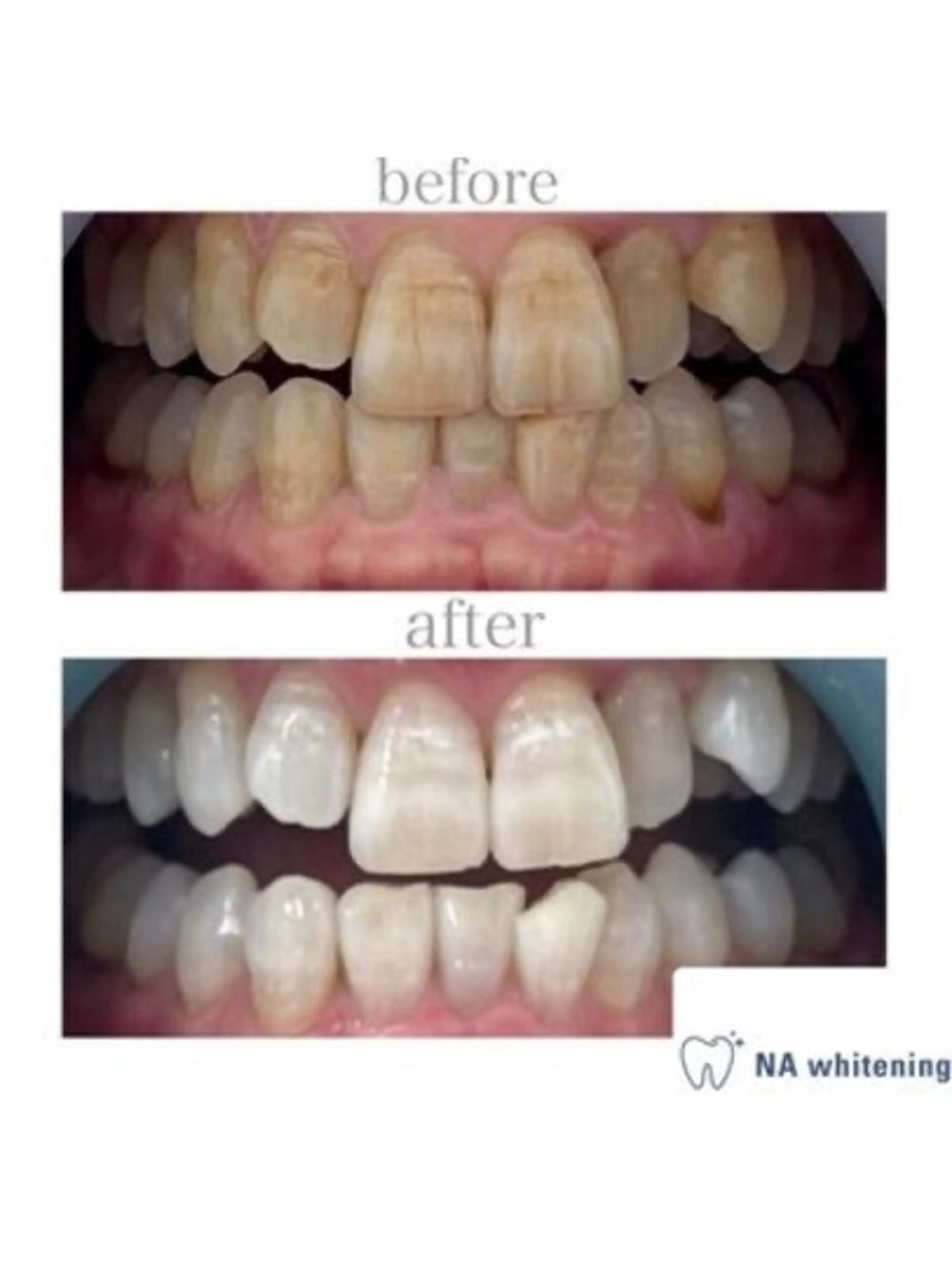 メンズ NAホワイトニング所属・NAホワイトニング /自由が丘のエステ・リラクイメージ