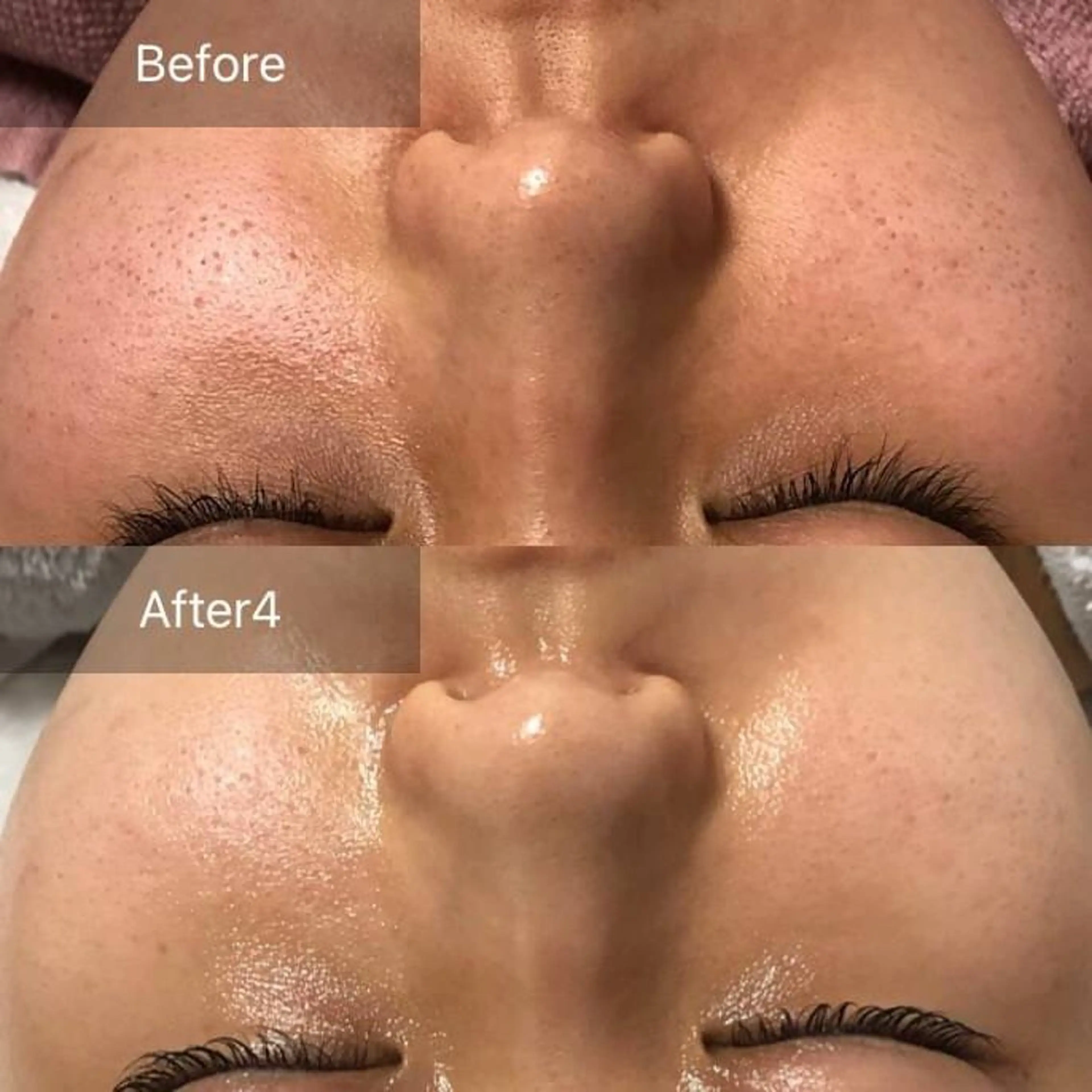 エステ リラク ALIA Scintiller  アリアサンティエ所属・齋藤 祐里耶のエステ・リラクイメージ