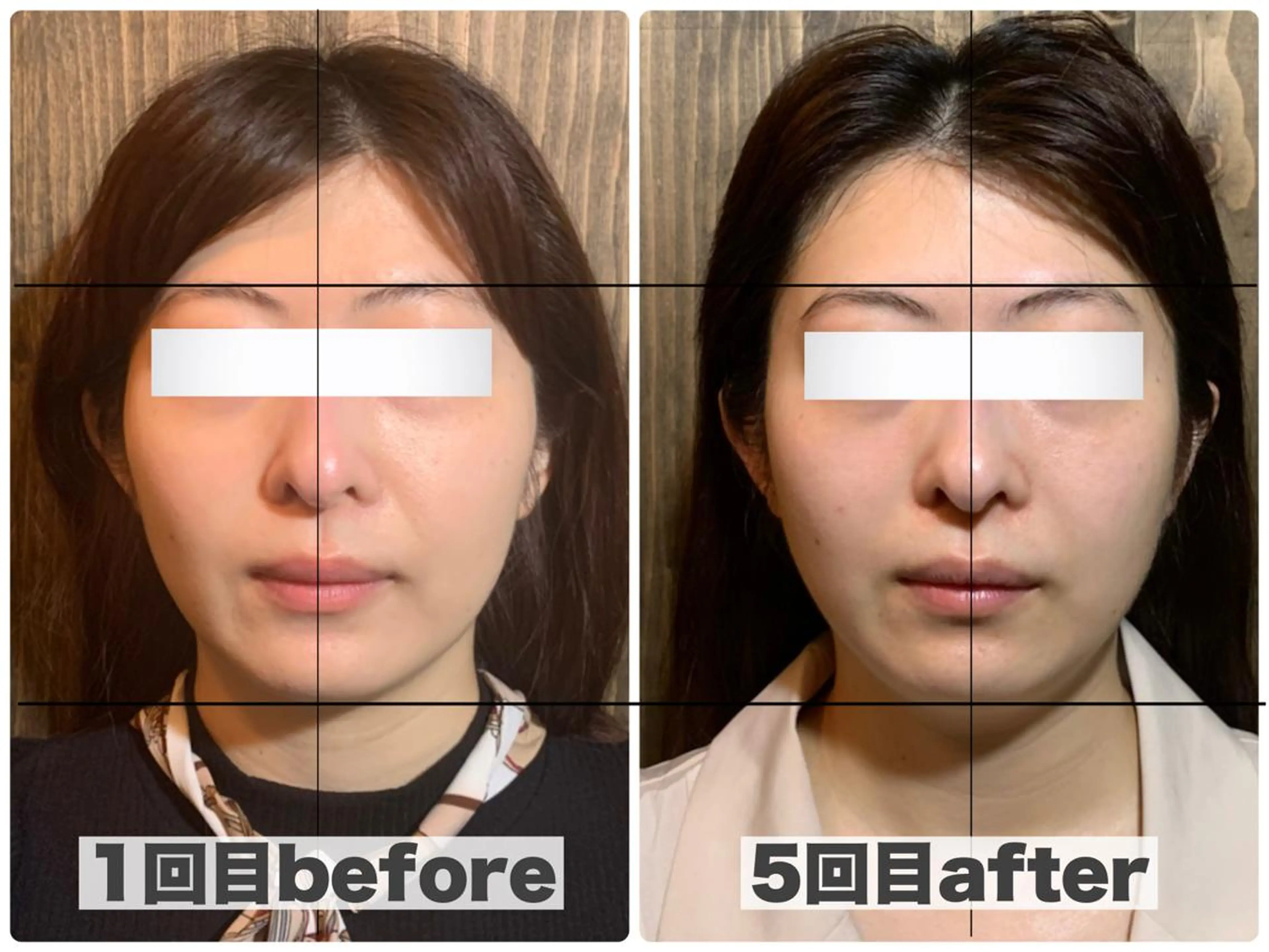 エステ リラク 💎後悔させない小顔 矯正💎イトヤマ🌱のエステ・リラクイメージ