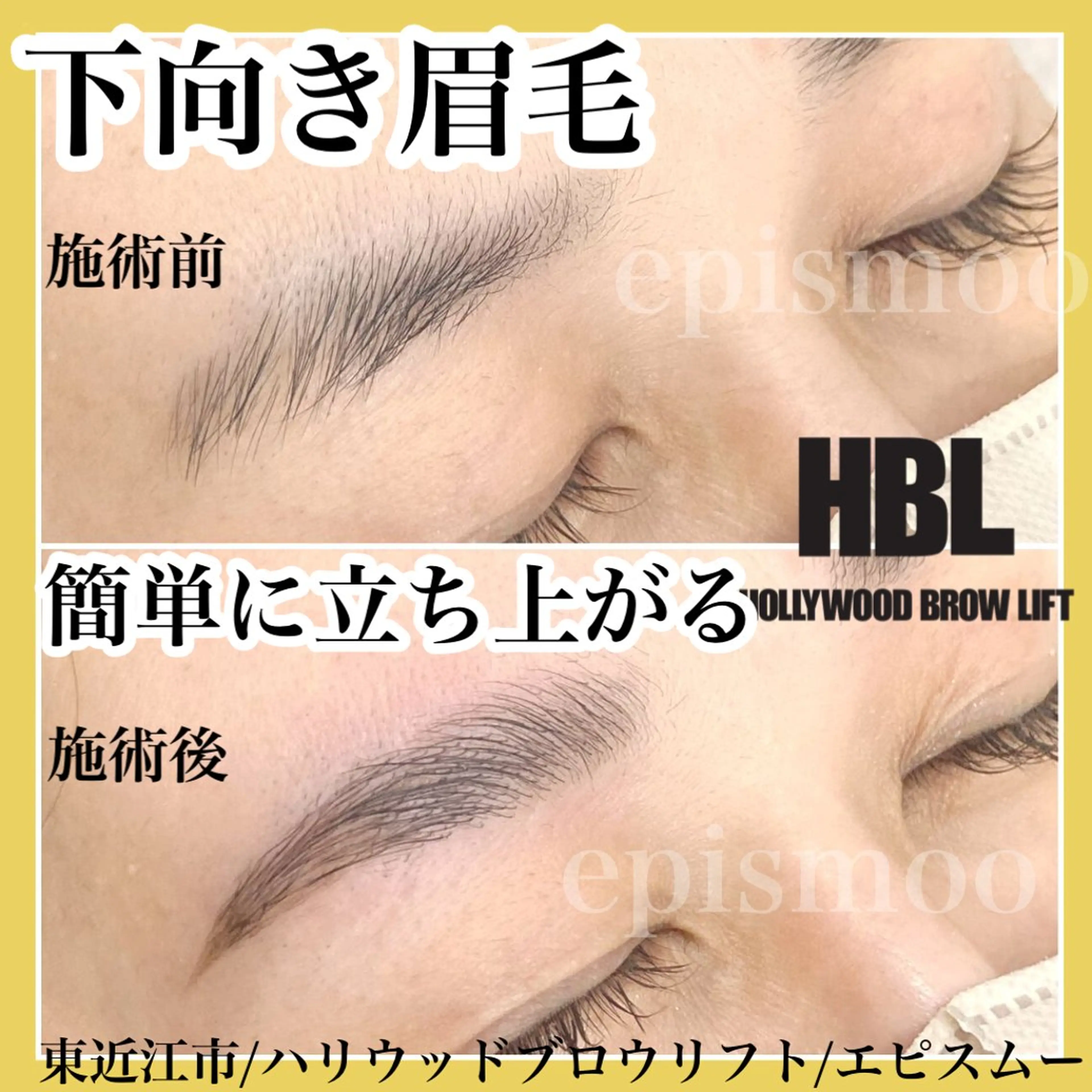 アイブロウ その他(アイブロウ) epismoo 脱毛/HBL/毛穴の眉毛・アイブロウイメージ
