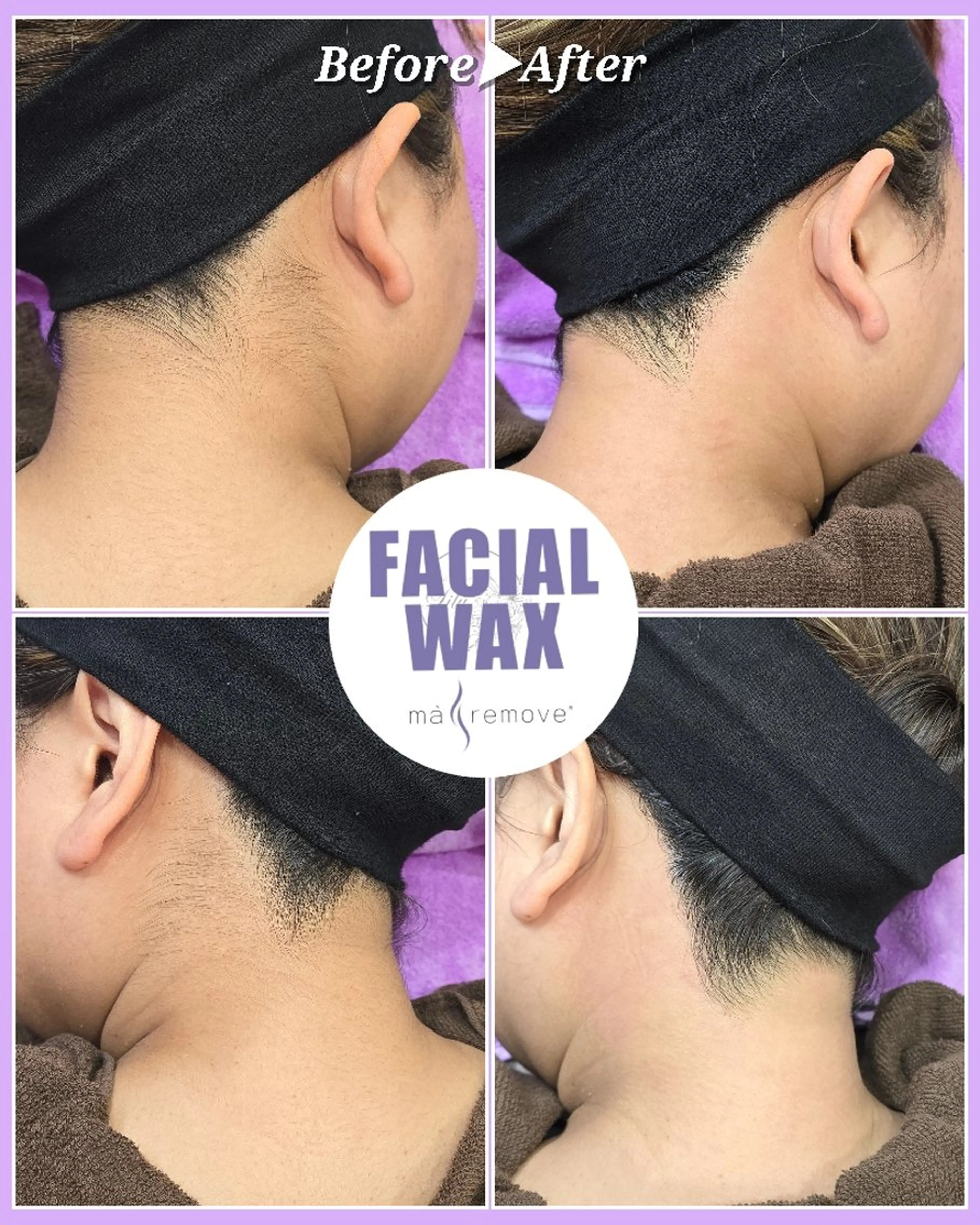 脱毛 facial salon Lily所属・salon Lilyのエステ・リラクイメージ