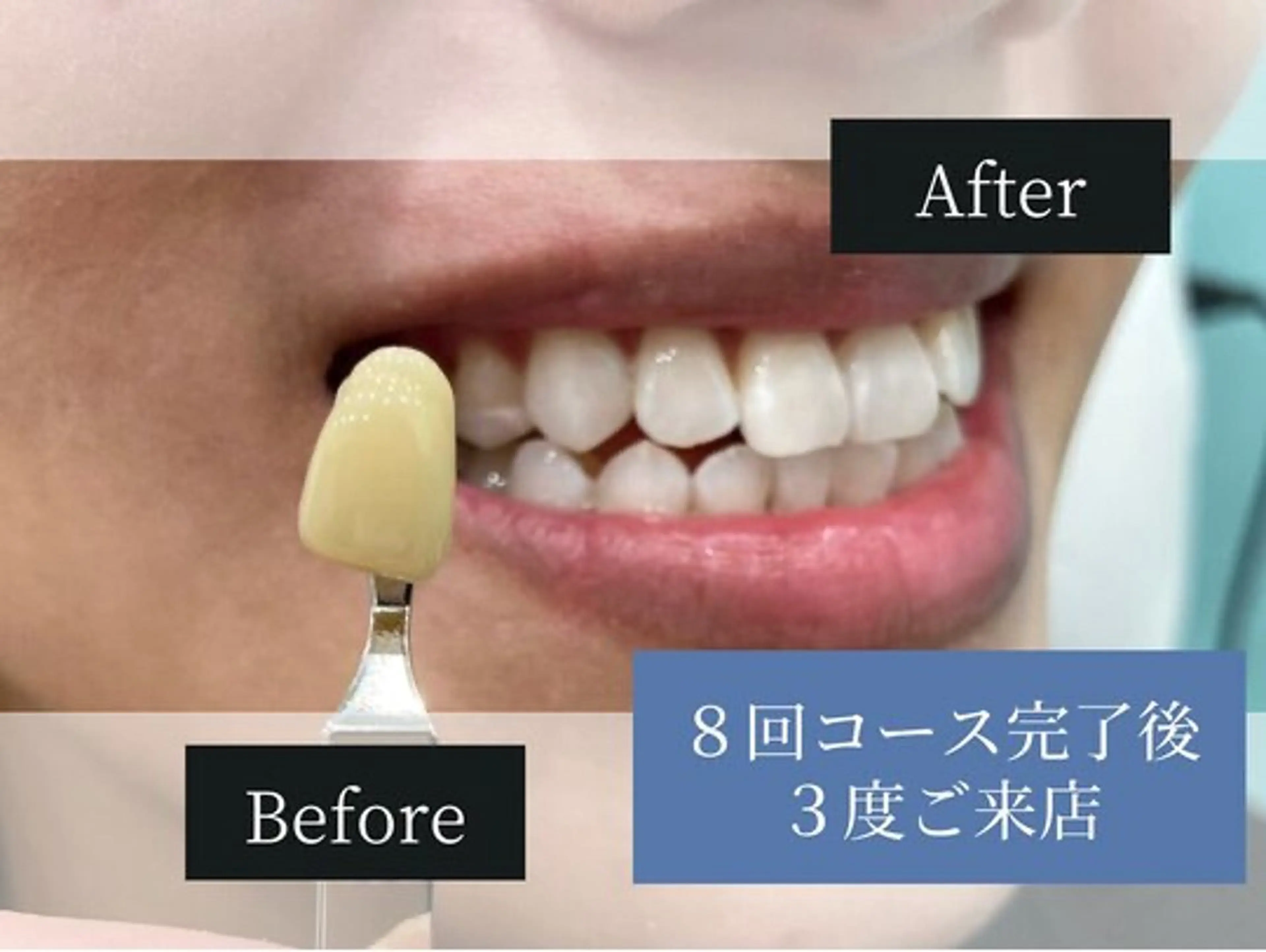 ホワイトニングカフェ荻窪店所属・ホワイトニングカフェ 荻窪店のその他イメージ