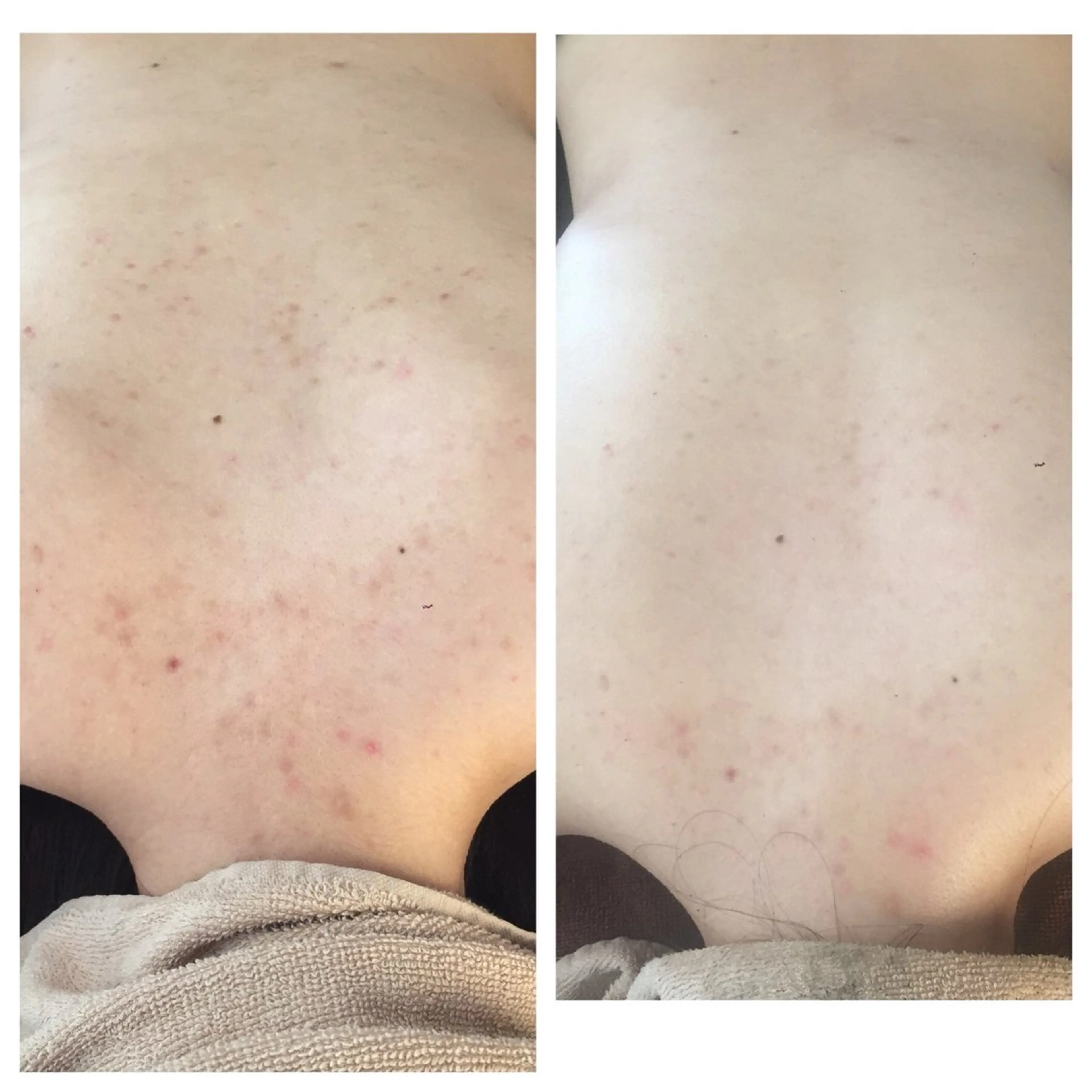 エステ 毛穴ニキビ専門 ビューティーグランツのエステ・リラクイメージ