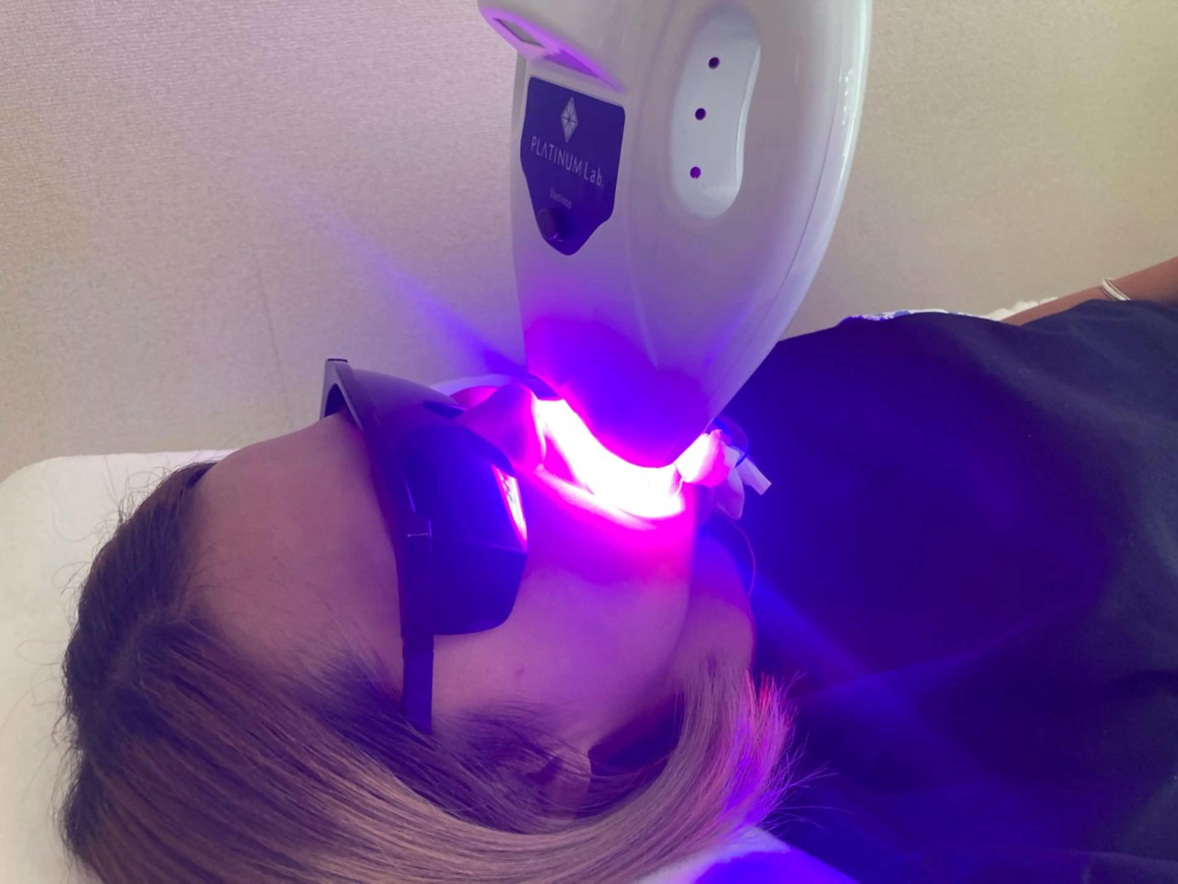 プラチナムビューティー柏所属・【歯科提携】柏ホワイ トニングスタイルのその他イメージ