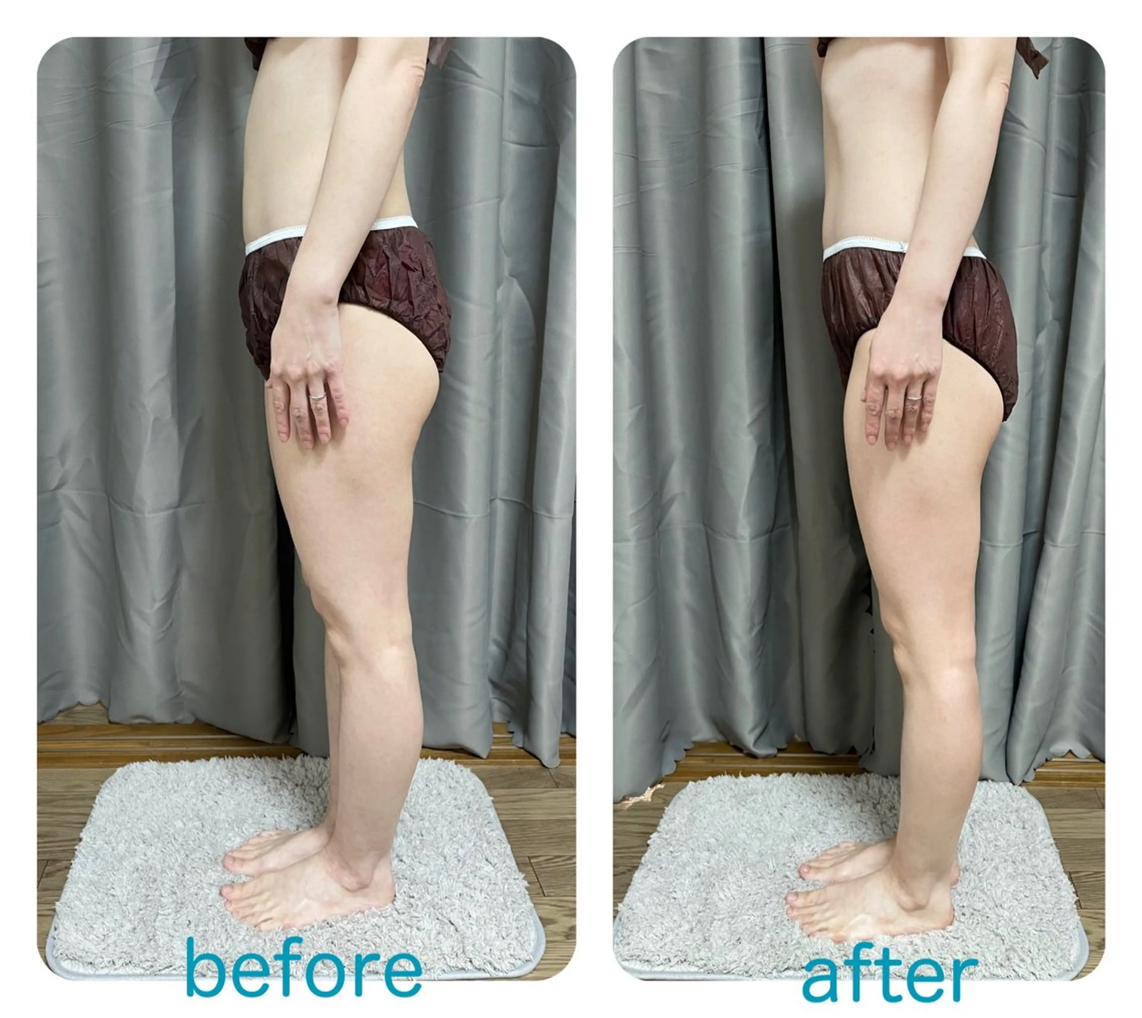 Loar 【痩身/小顔エステサロン】所属・Loar エステ中野 絵里奈のエステ・リラクイメージ