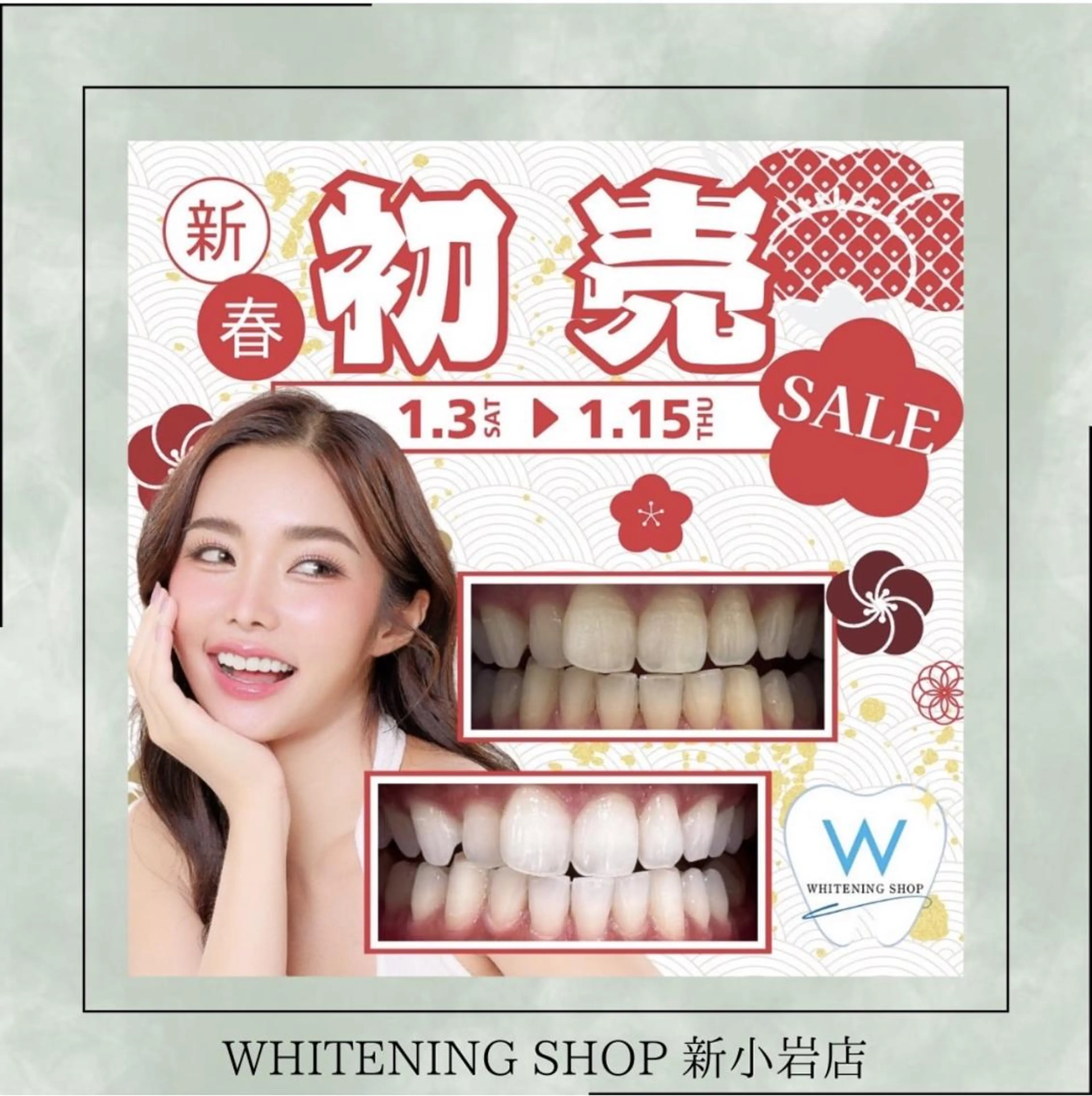 メンズ その他 ホワイトニング ショップ新小岩店のその他イメージ