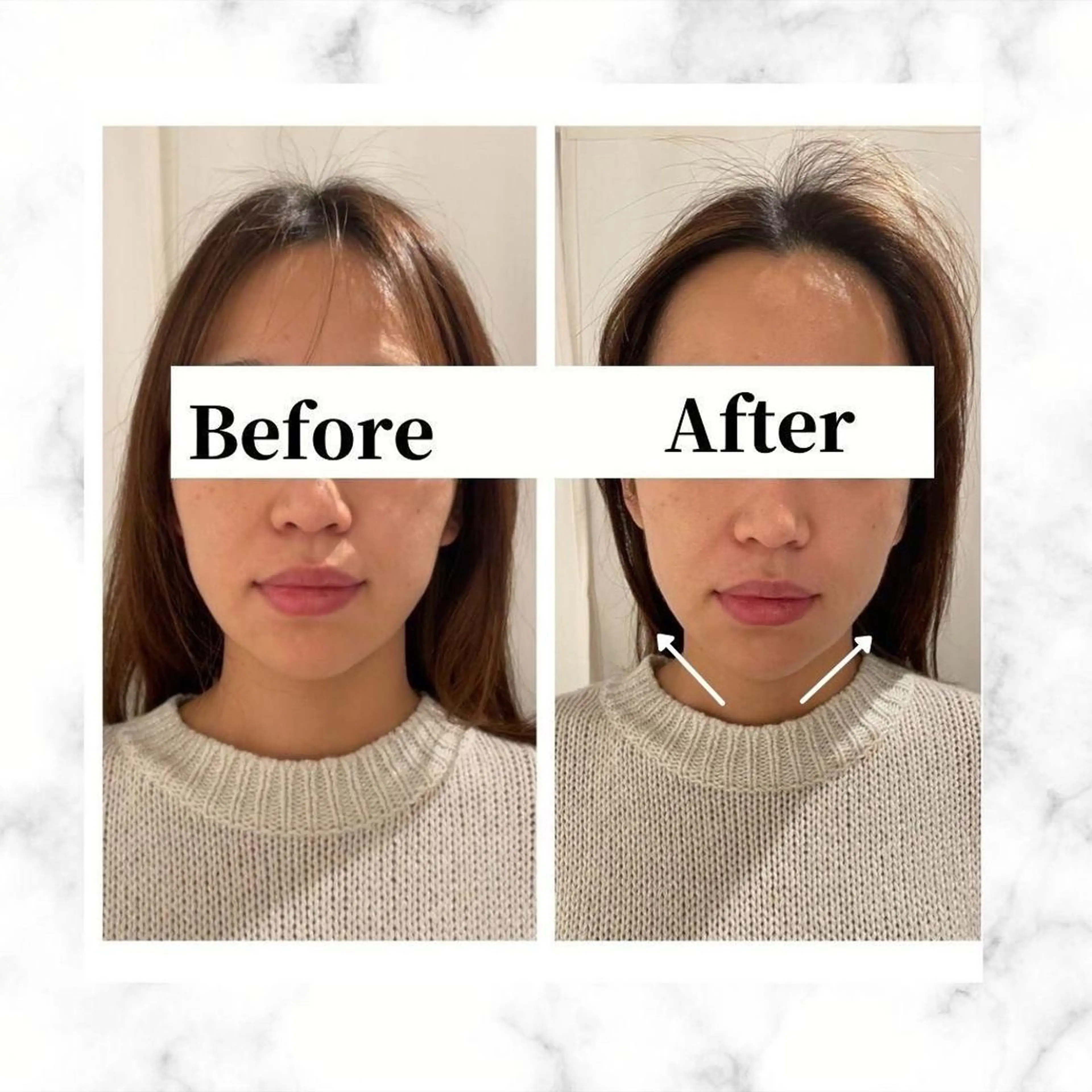 エステ リラク 12Dハイフ💗 最強小顔のエステ・リラクイメージ