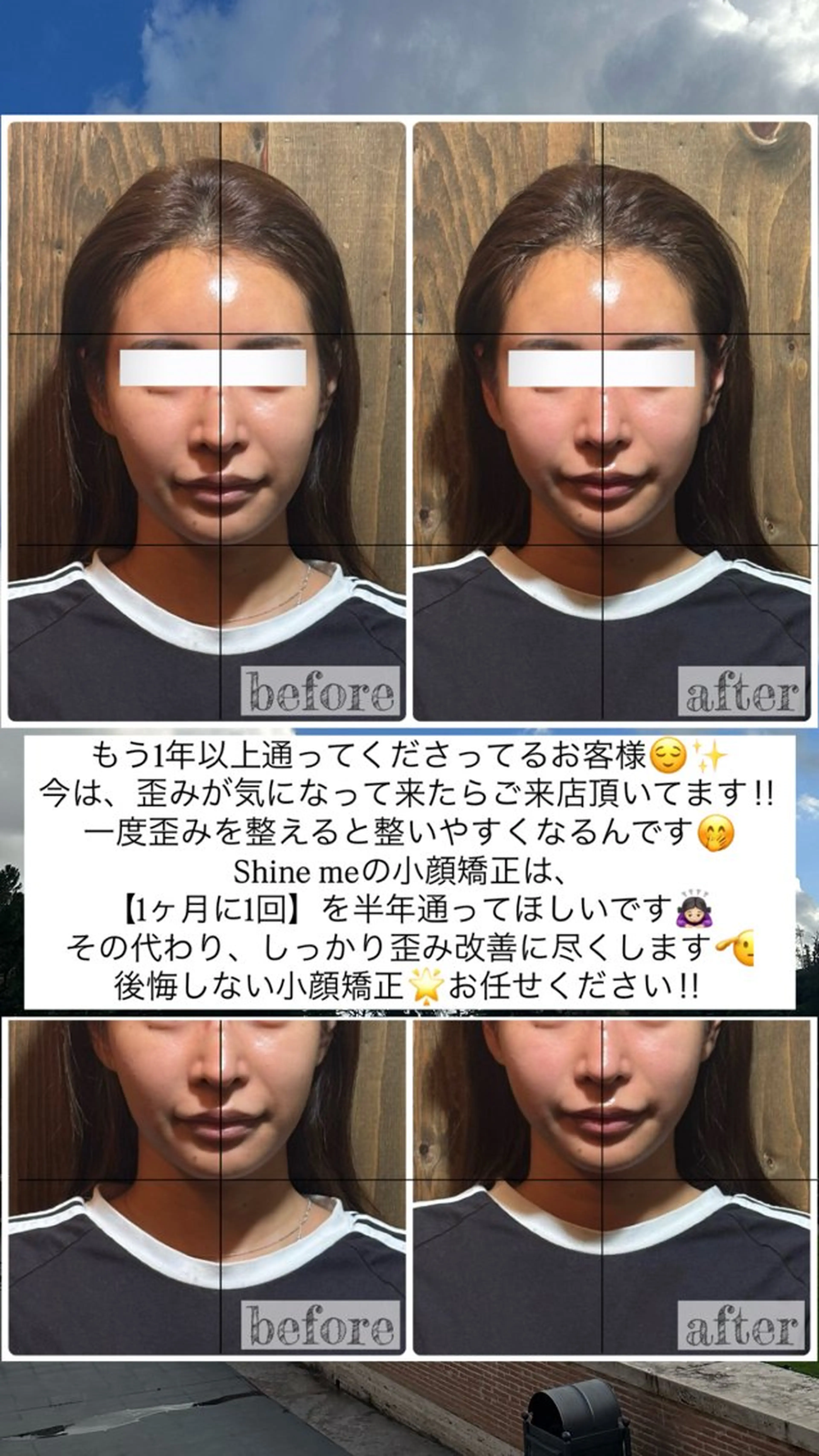 エステ リラク 💎後悔させない小顔 矯正💎イトヤマ🌱のエステ・リラクイメージ