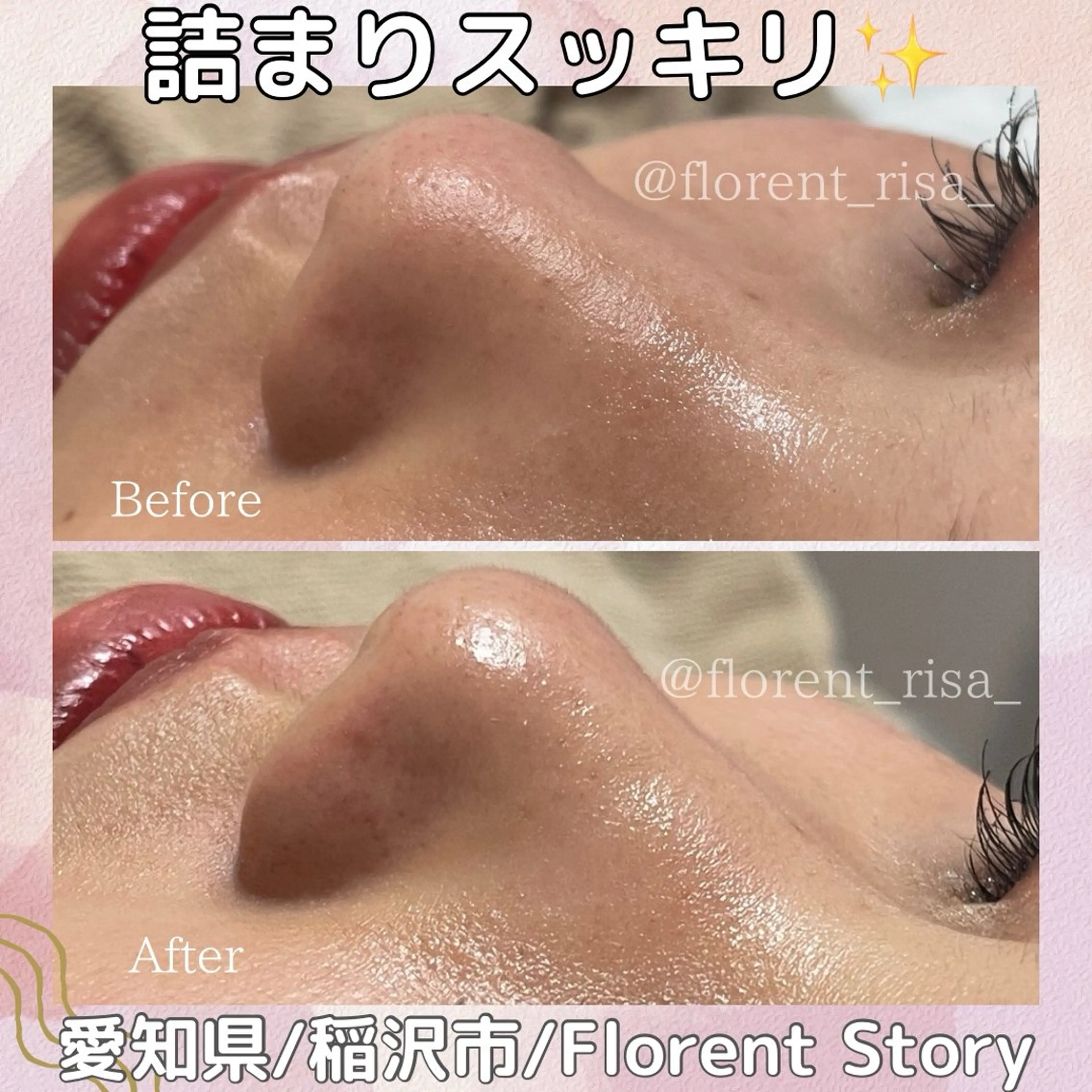 エステ 田中 里沙のエステ・リラクイメージ