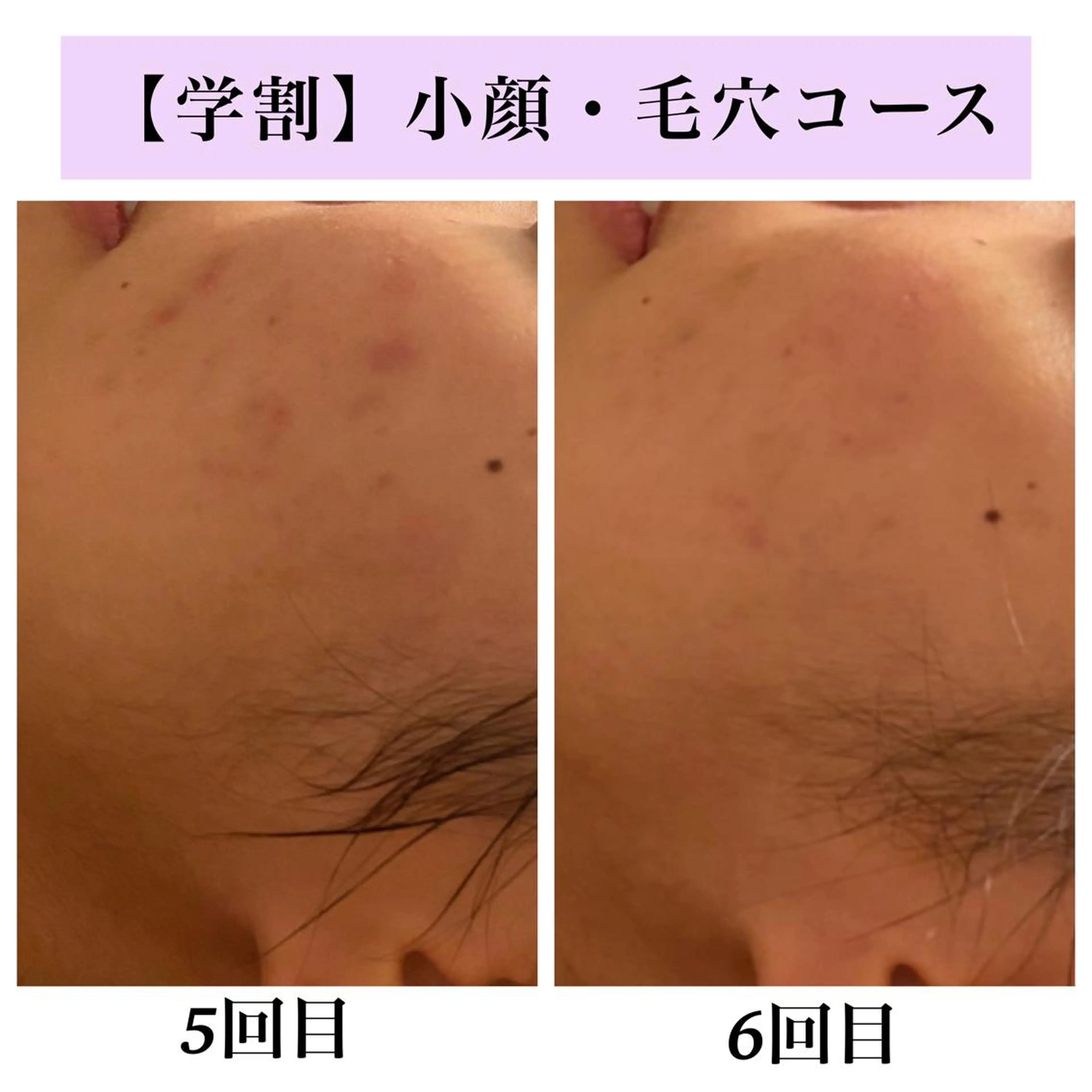 Bellesthe （ベルエステ）のエステ・リラクイメージ