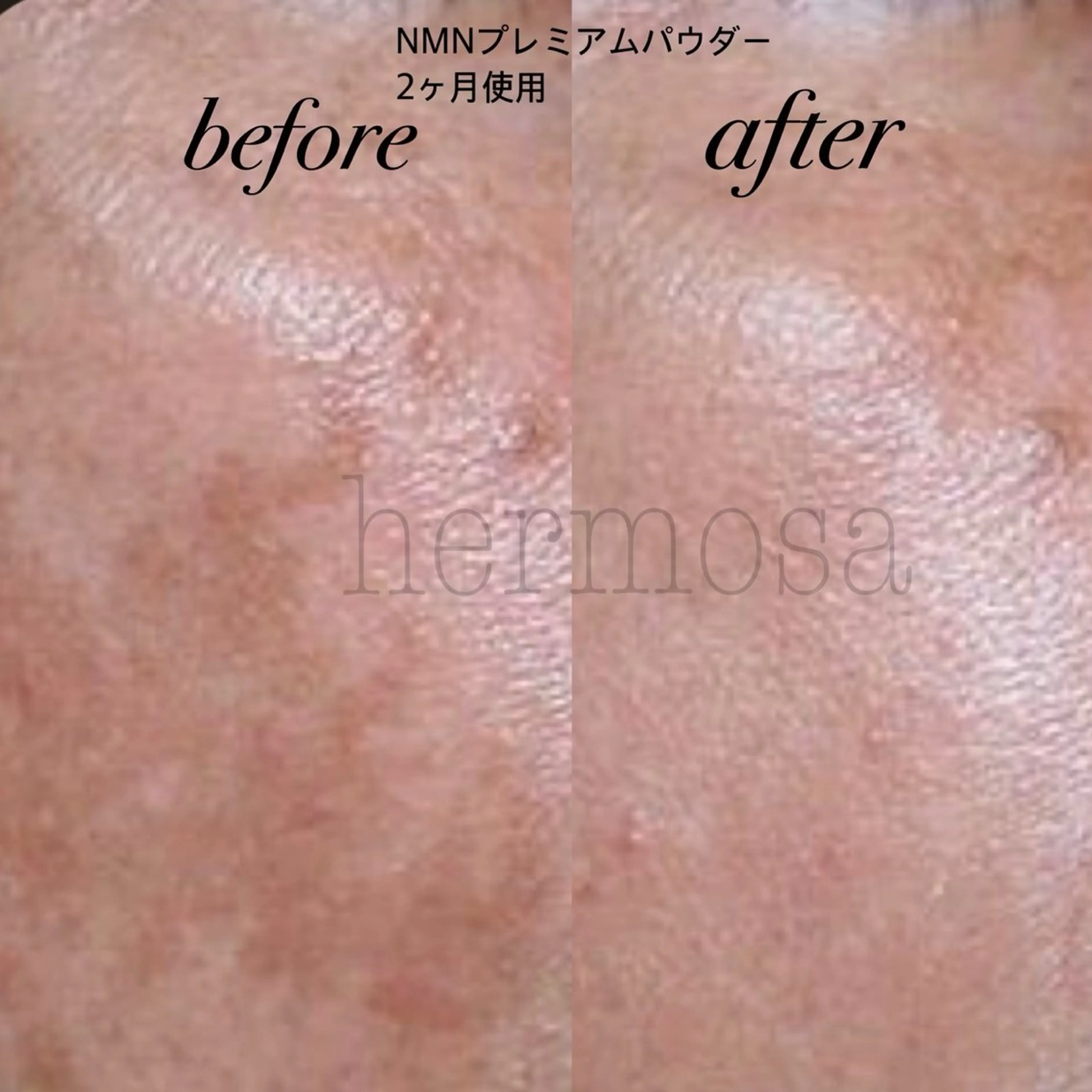 オールハンド フェイシャルのエステ・リラクイメージ