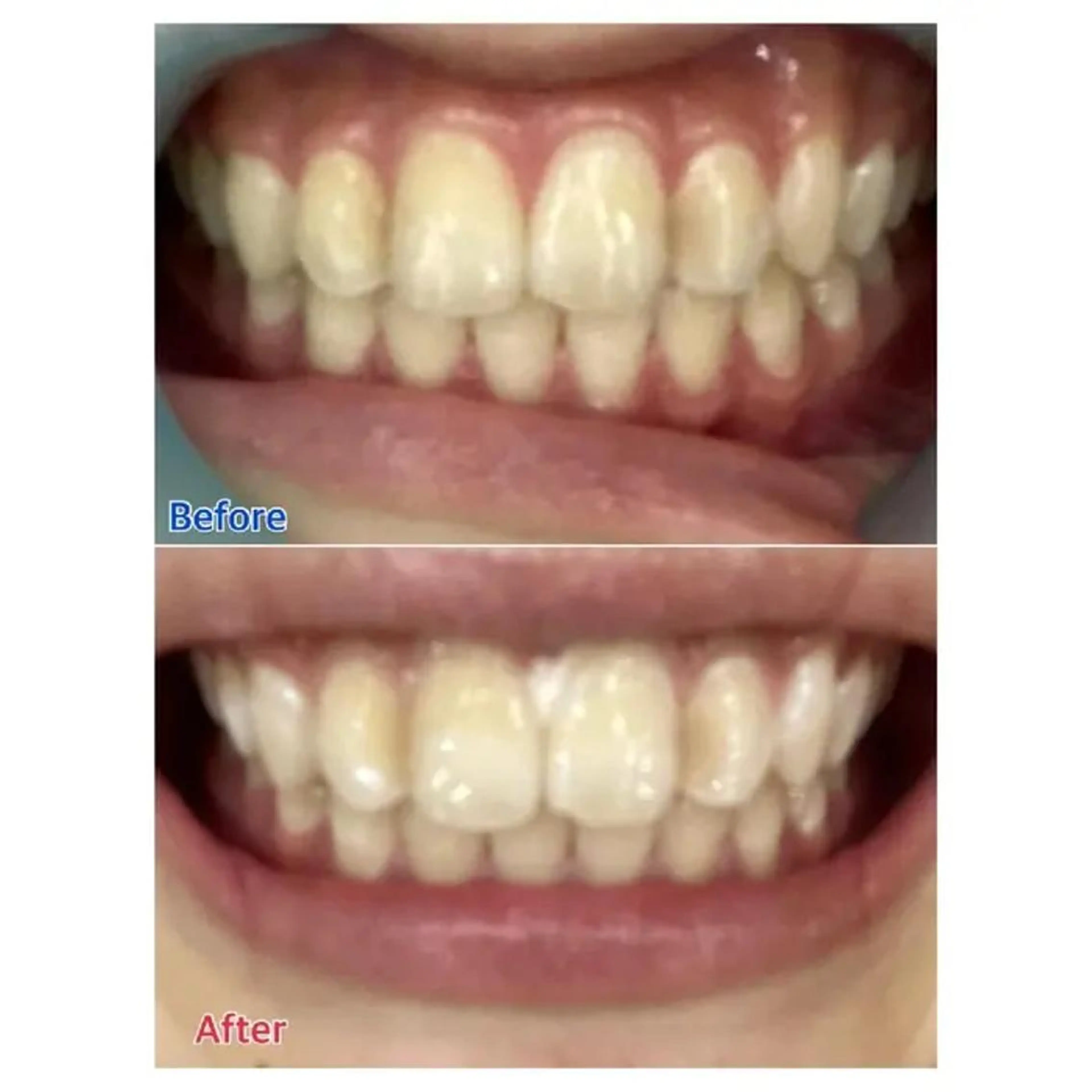 M渋谷店所属・Ｍ渋谷 ホワイトニングのその他イメージ