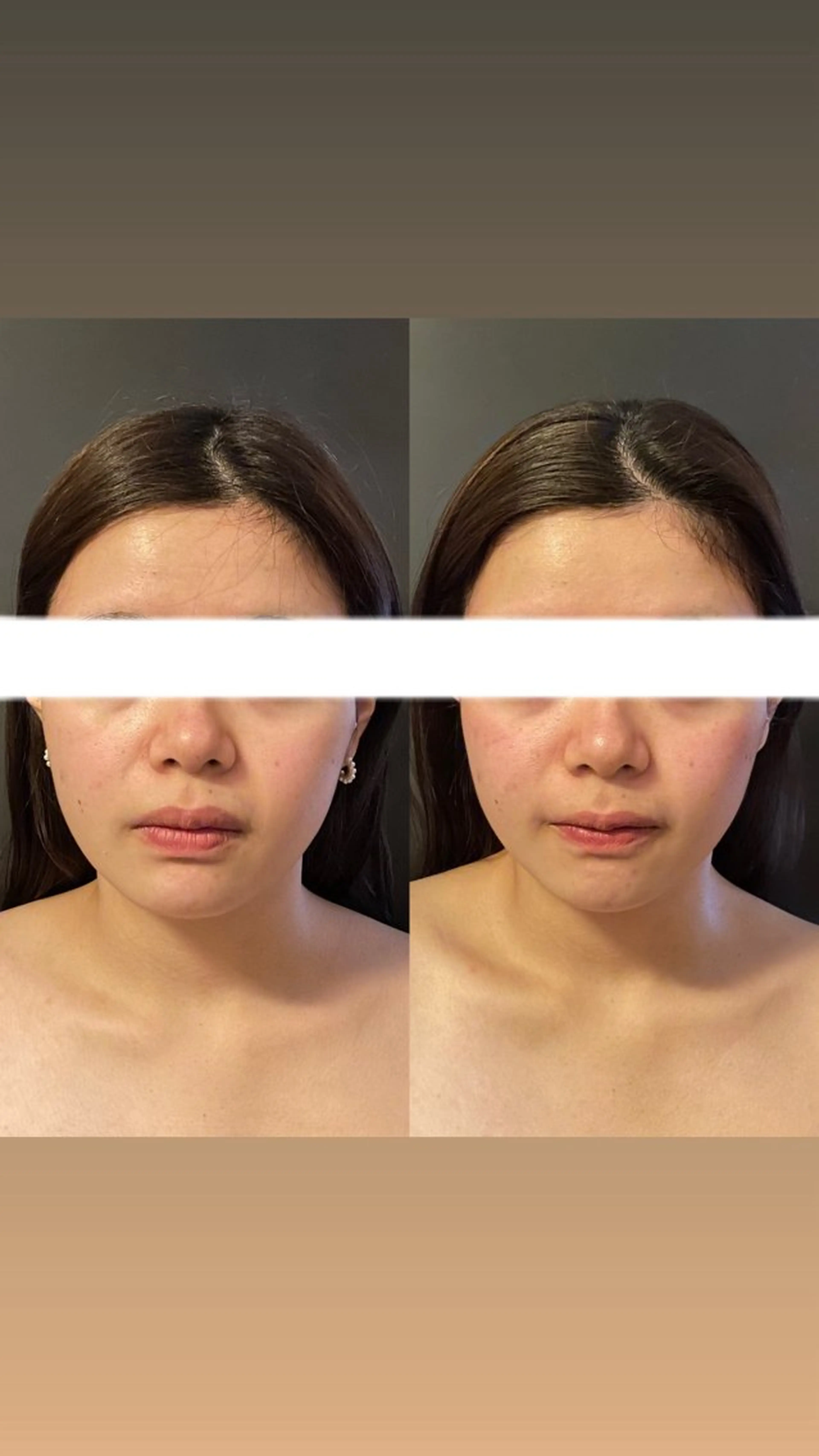 エステ リラク エステサロンino.colore'所属・小顔サロン ino.coloreのエステ・リラクイメージ