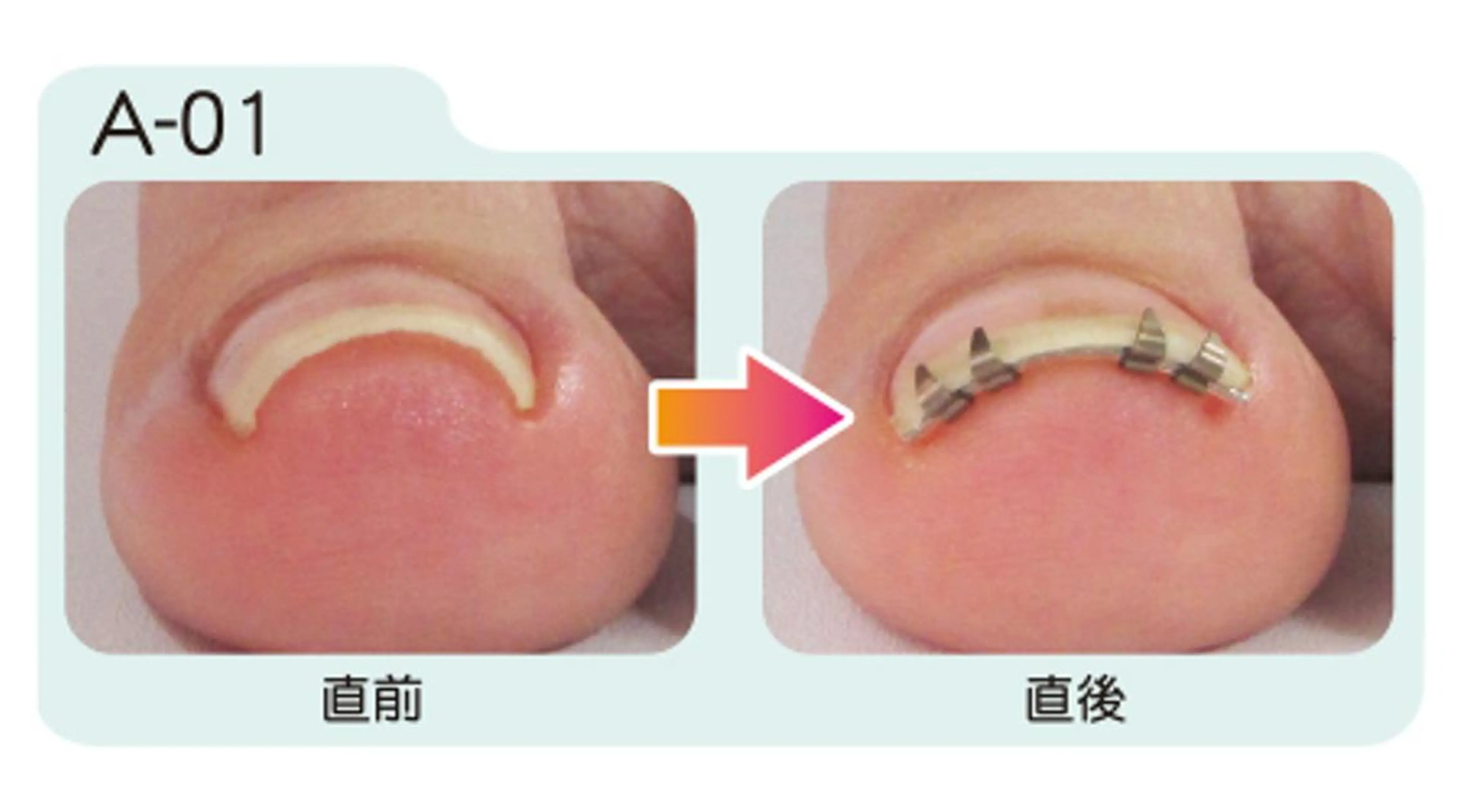 ネイル フットネイル nail salon ワンミリオンのネイルデザイン