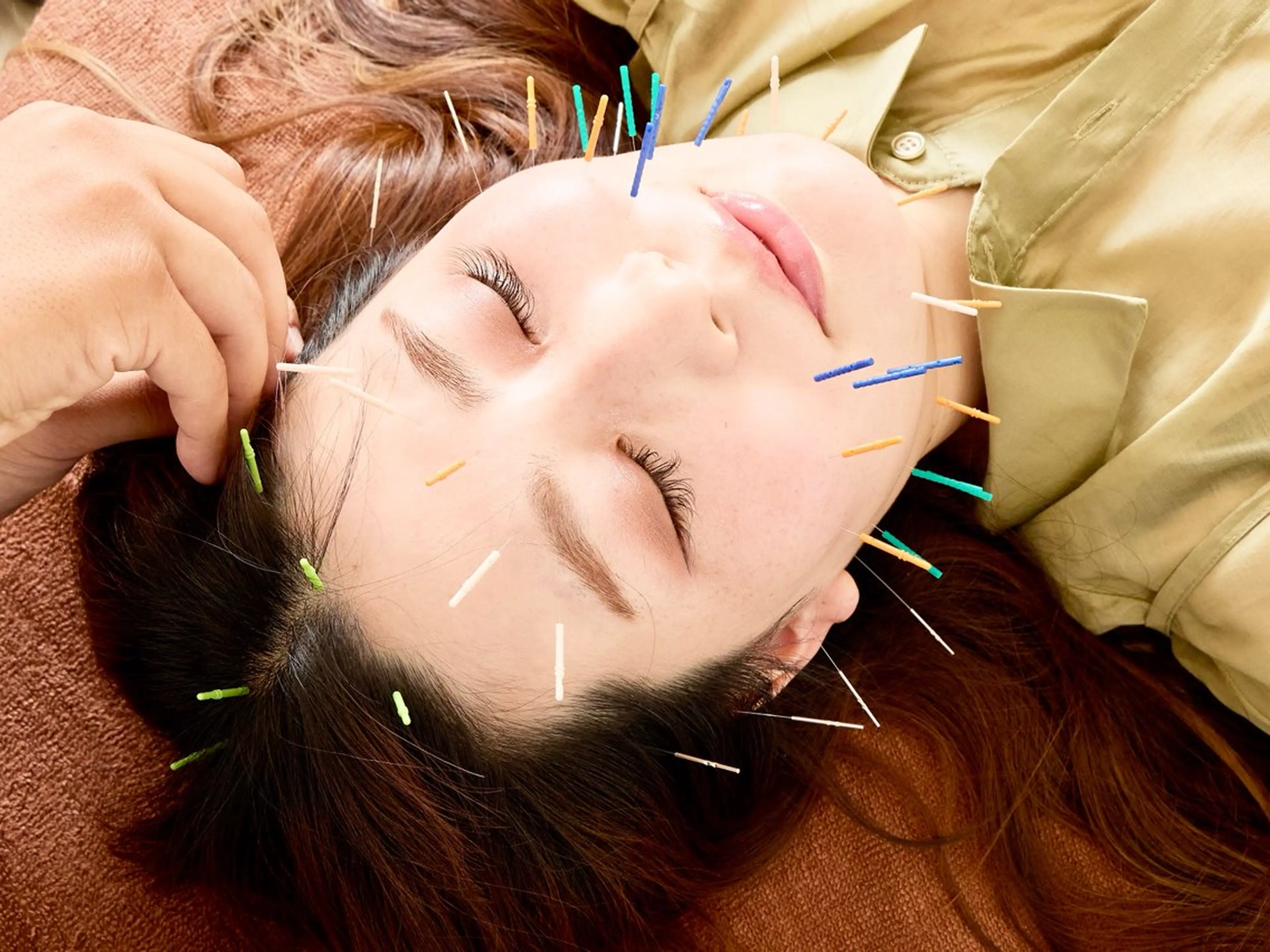 HARIKARA式美容鍼&美容整体でコンプレックスを改善◎の写真