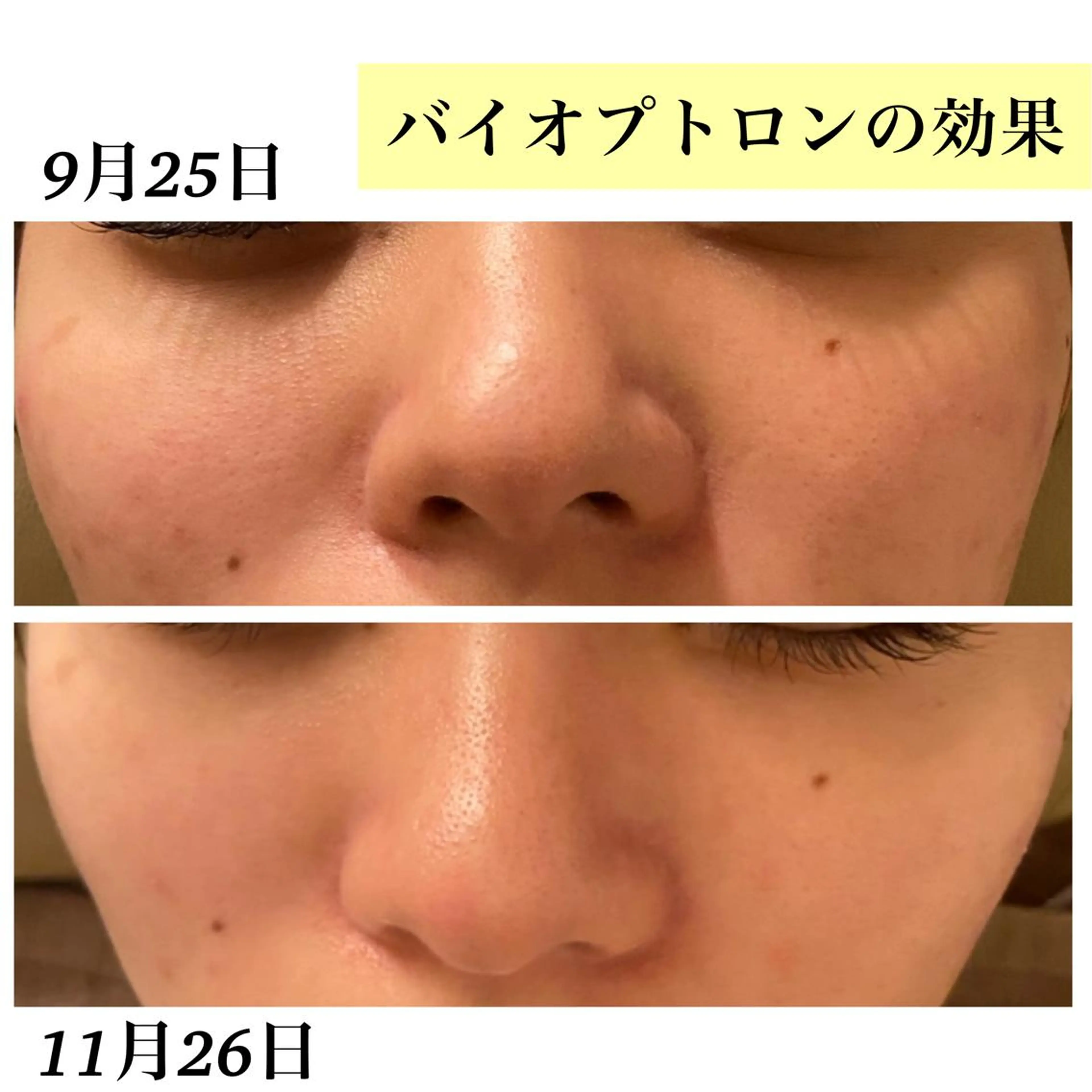 Bellesthe （ベルエステ）のエステ・リラクイメージ