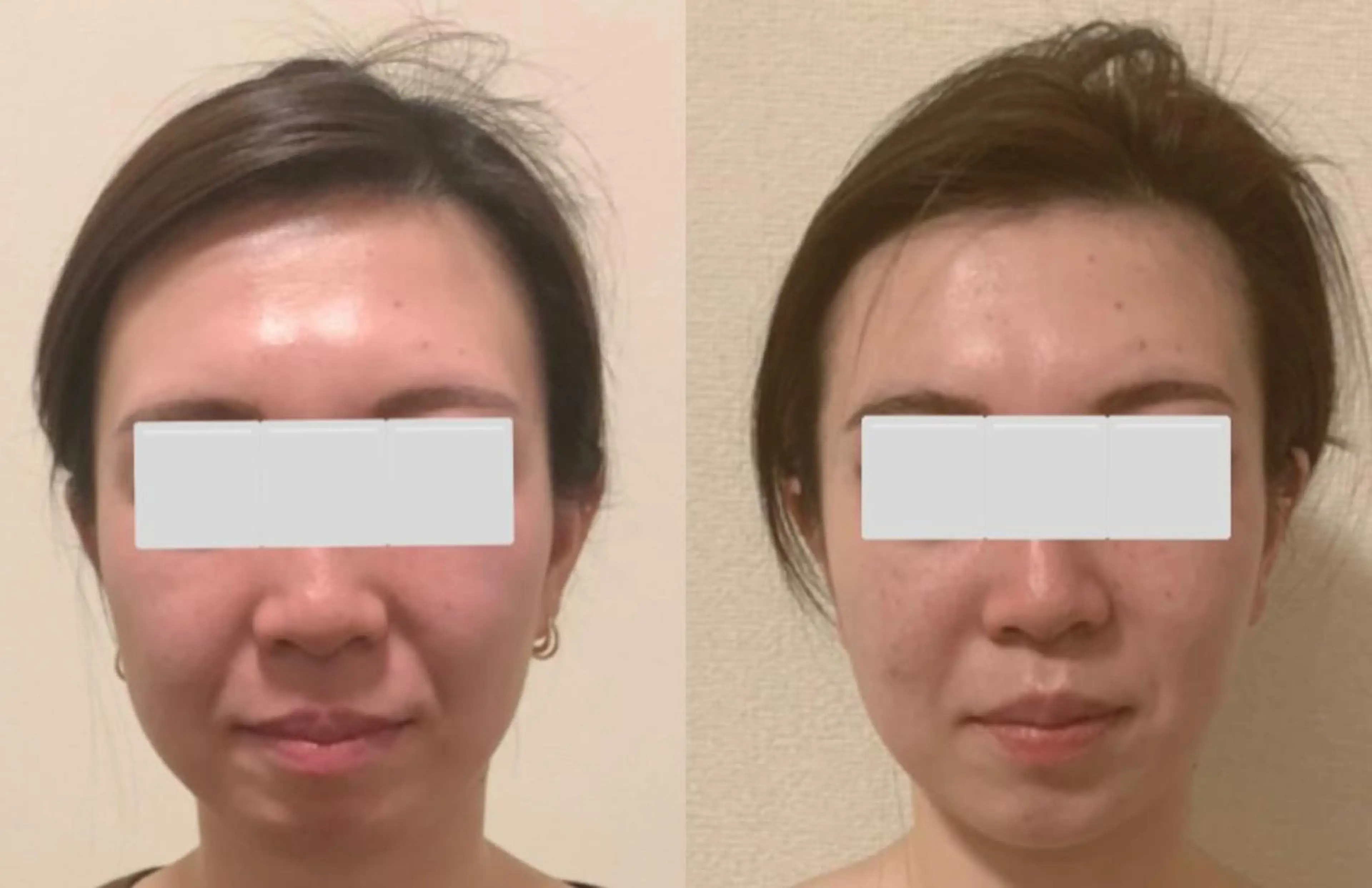 a  room salonのエステ・リラクイメージ