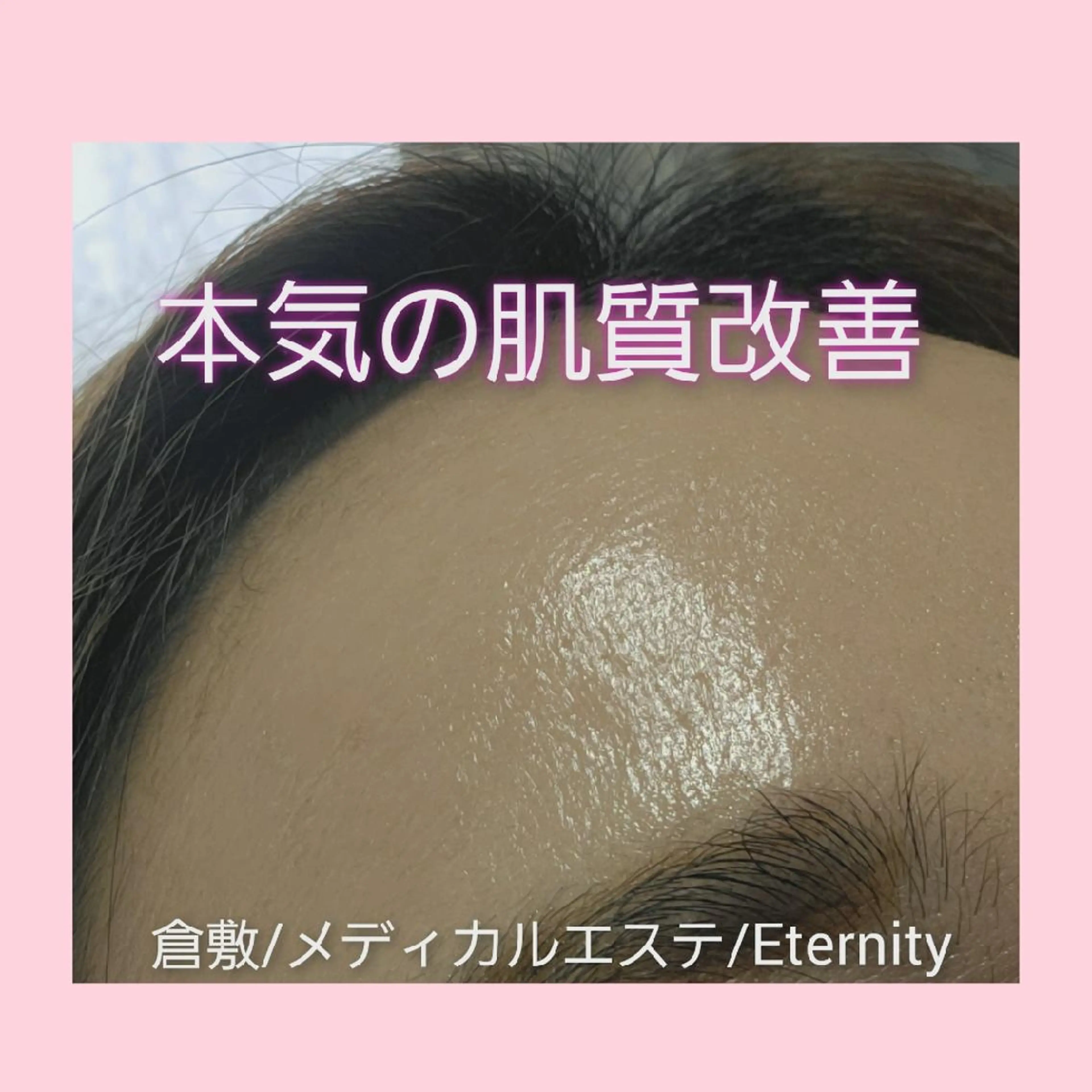 エステ パーソナルカラー・骨格/顔診断【eternity】所属・【トータル美容】 Eternityのその他イメージ