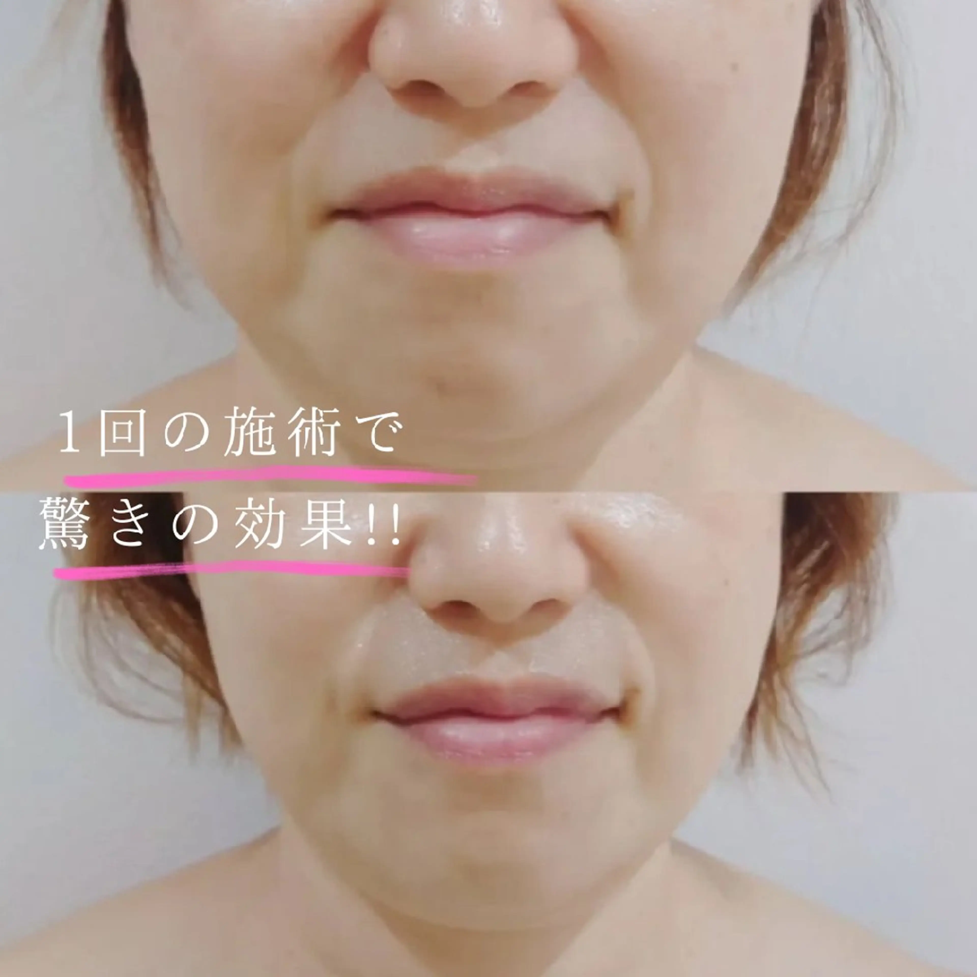 ブライトサロン所属・☆ブライトサロン☆ 東瑞希のエステ・リラクイメージ