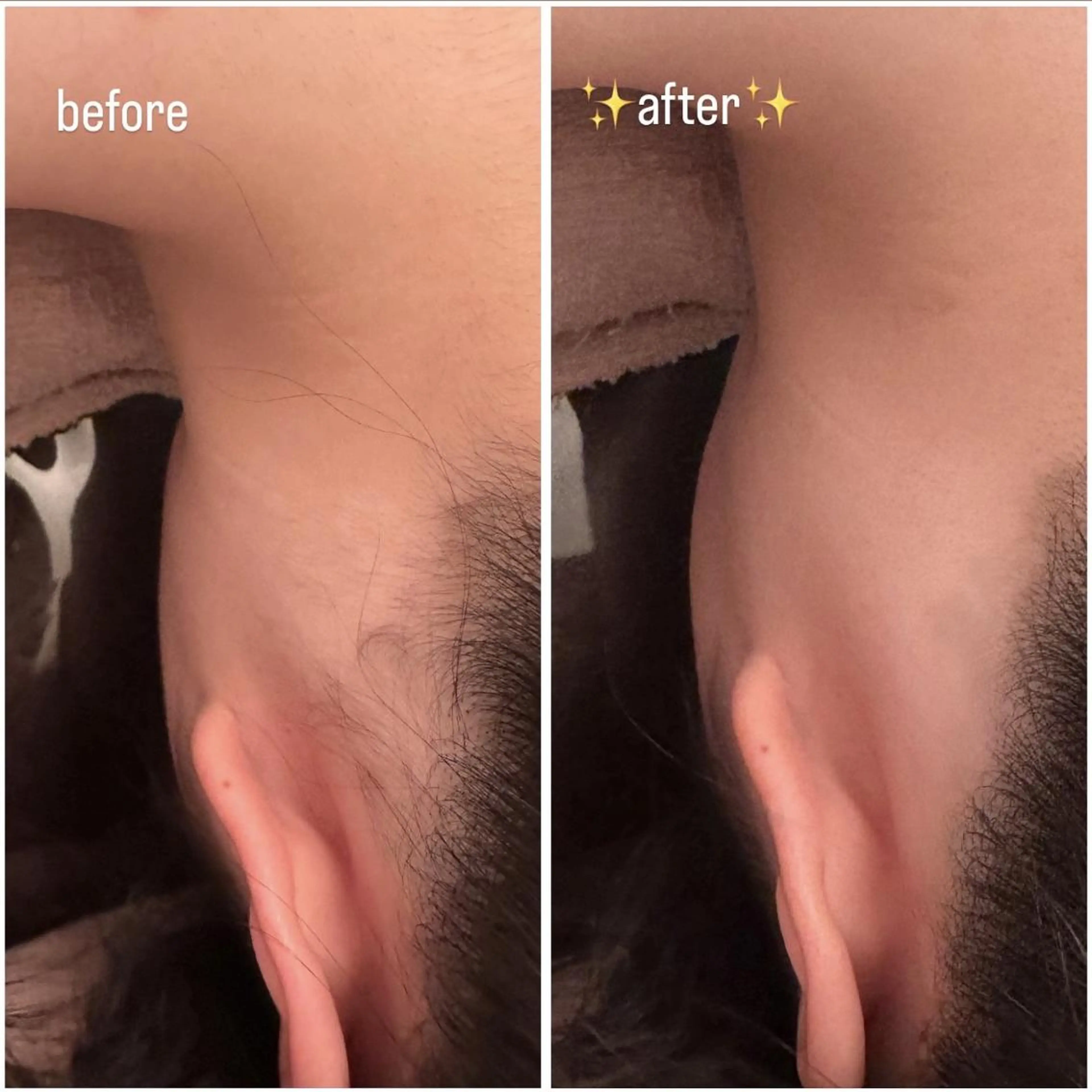 脱毛 鈴木 愛花のエステ・リラクイメージ