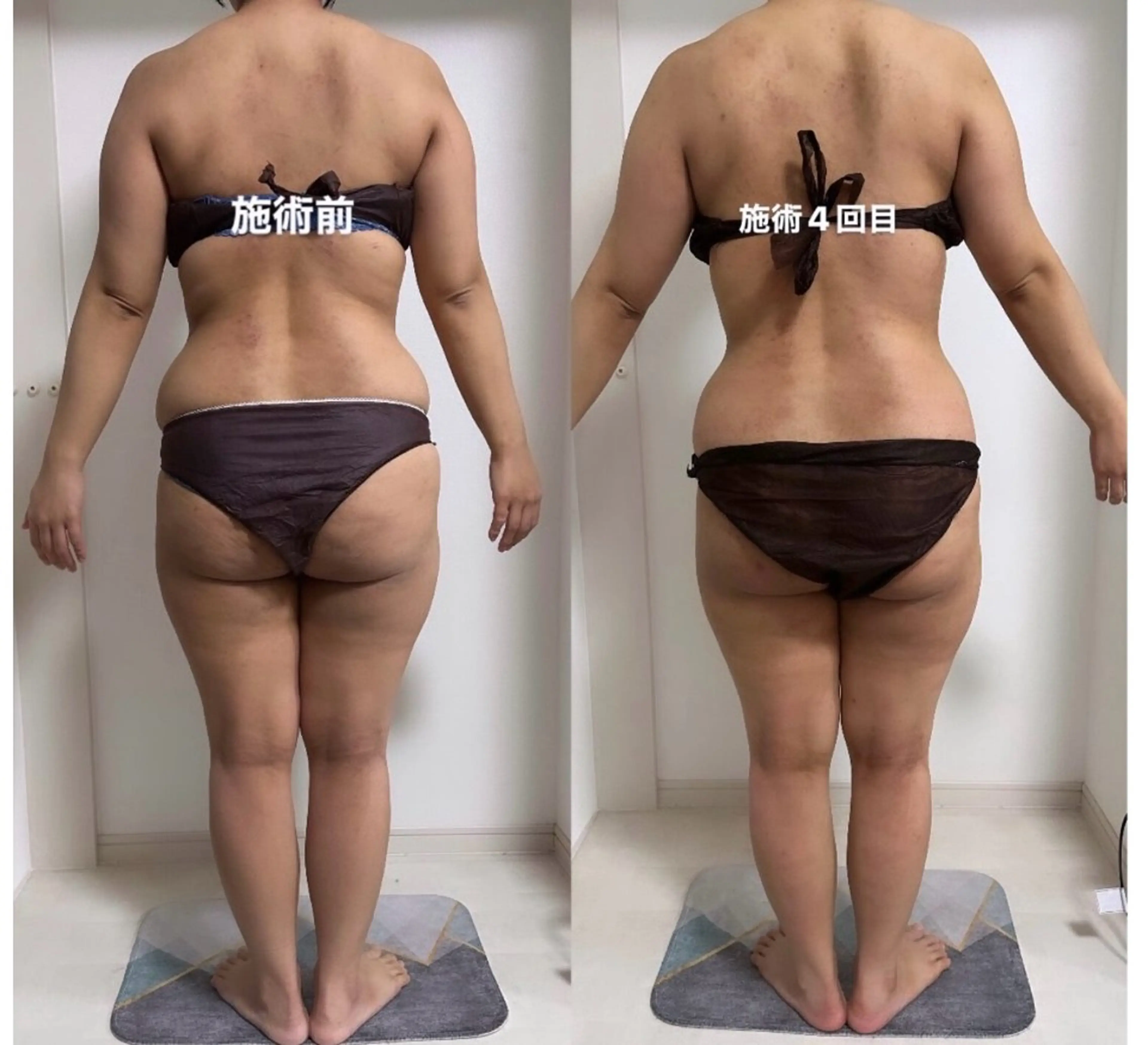 IBERIA心斎橋店 🌼凝り小顔美肌痩身のエステ・リラクイメージ