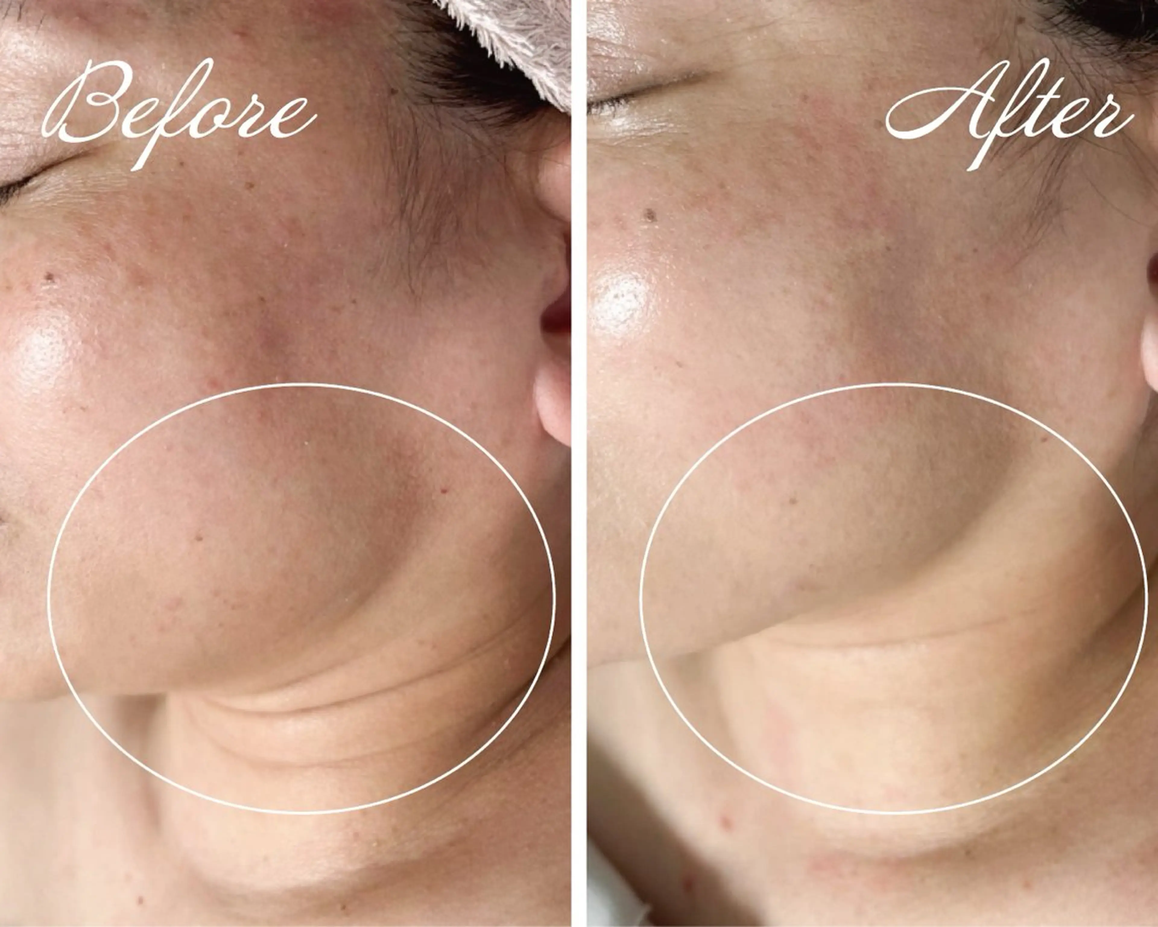 エステ リラク emire beauty salon所属・村上 玲奈のエステ・リラクイメージ