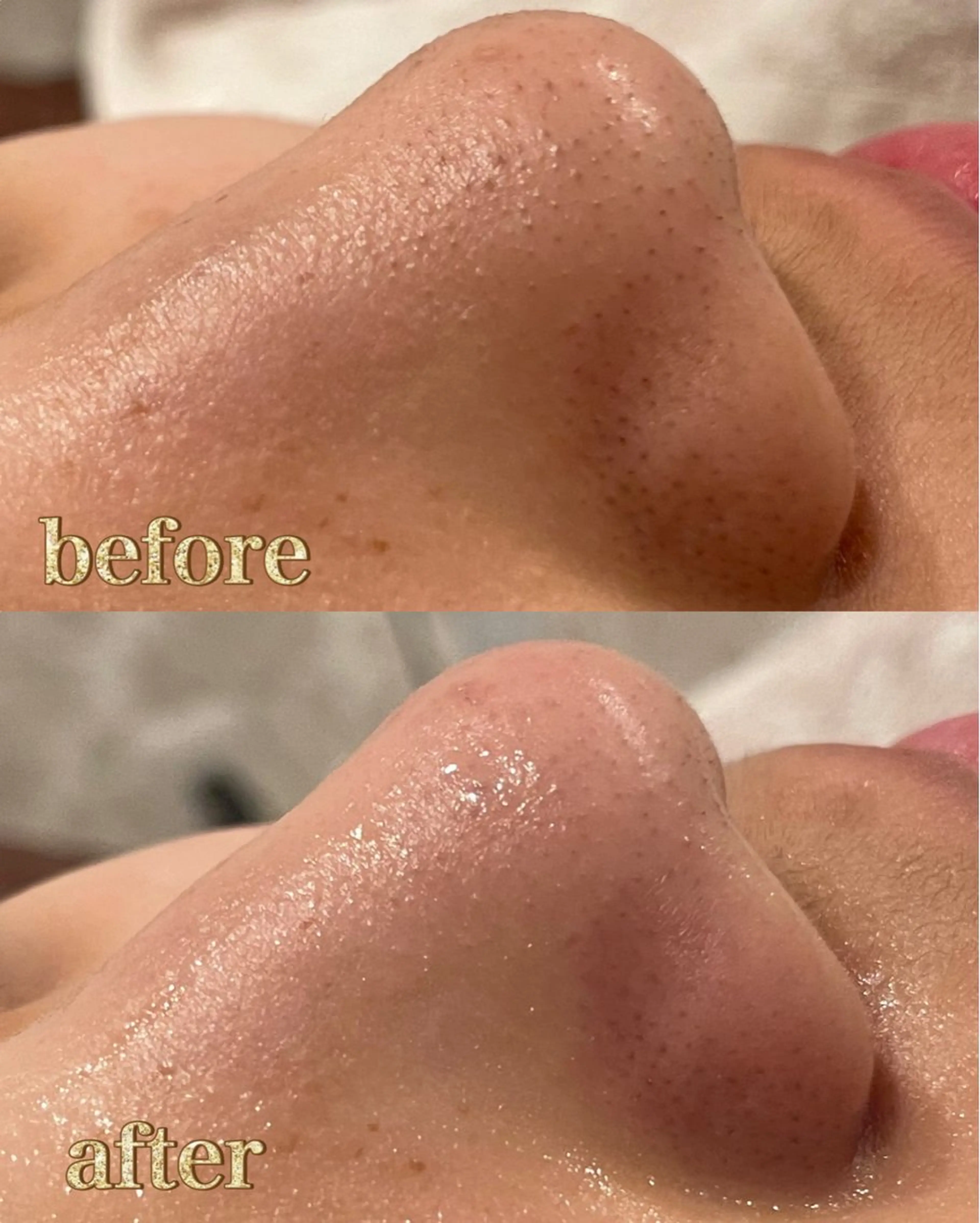 La・Bellvie所属・La･Bellvie 【星ヶ丘店]のエステ・リラクイメージ