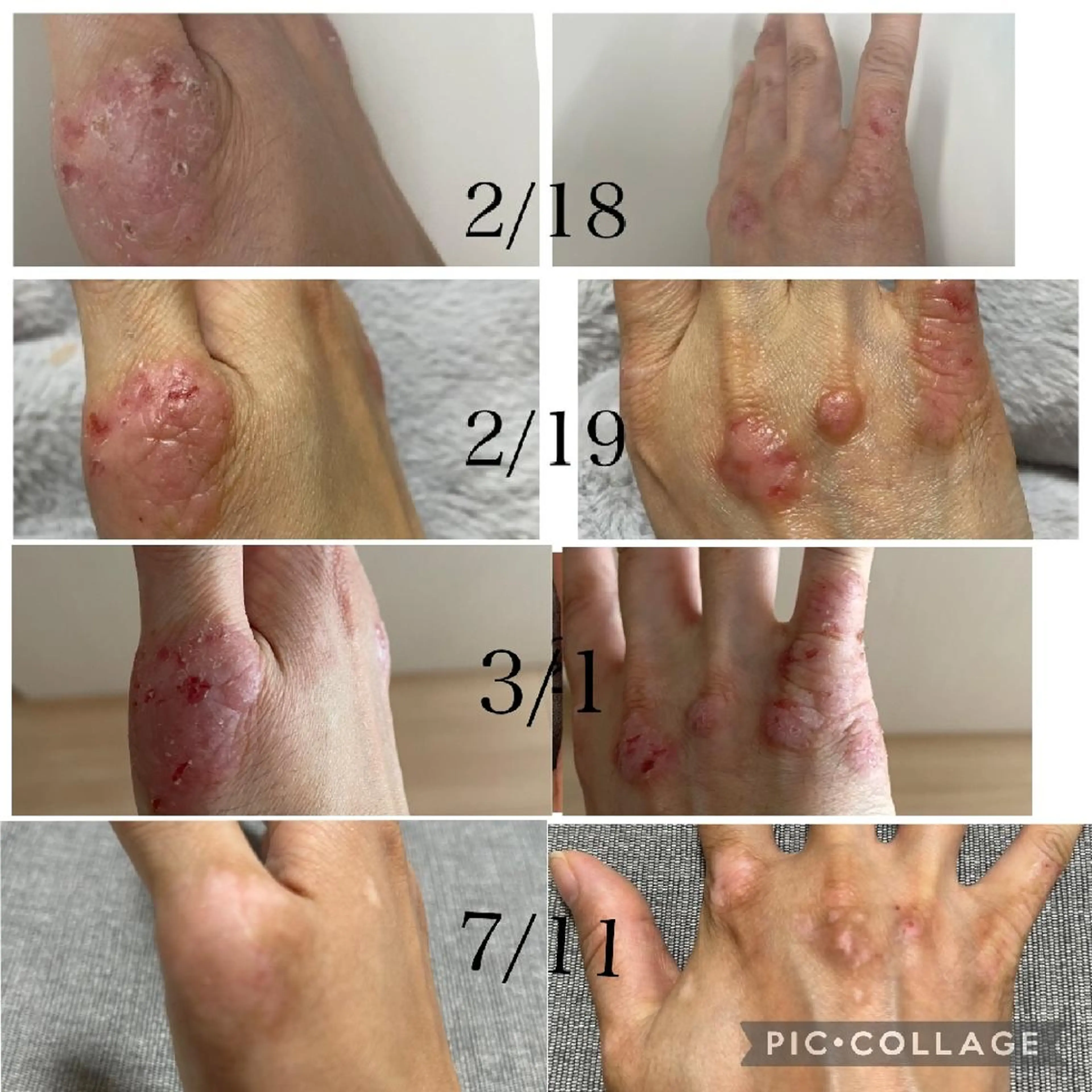 デ・アイム王寺所属・たるみ解消エミリーノ 米田真美子のエステ・リラクイメージ