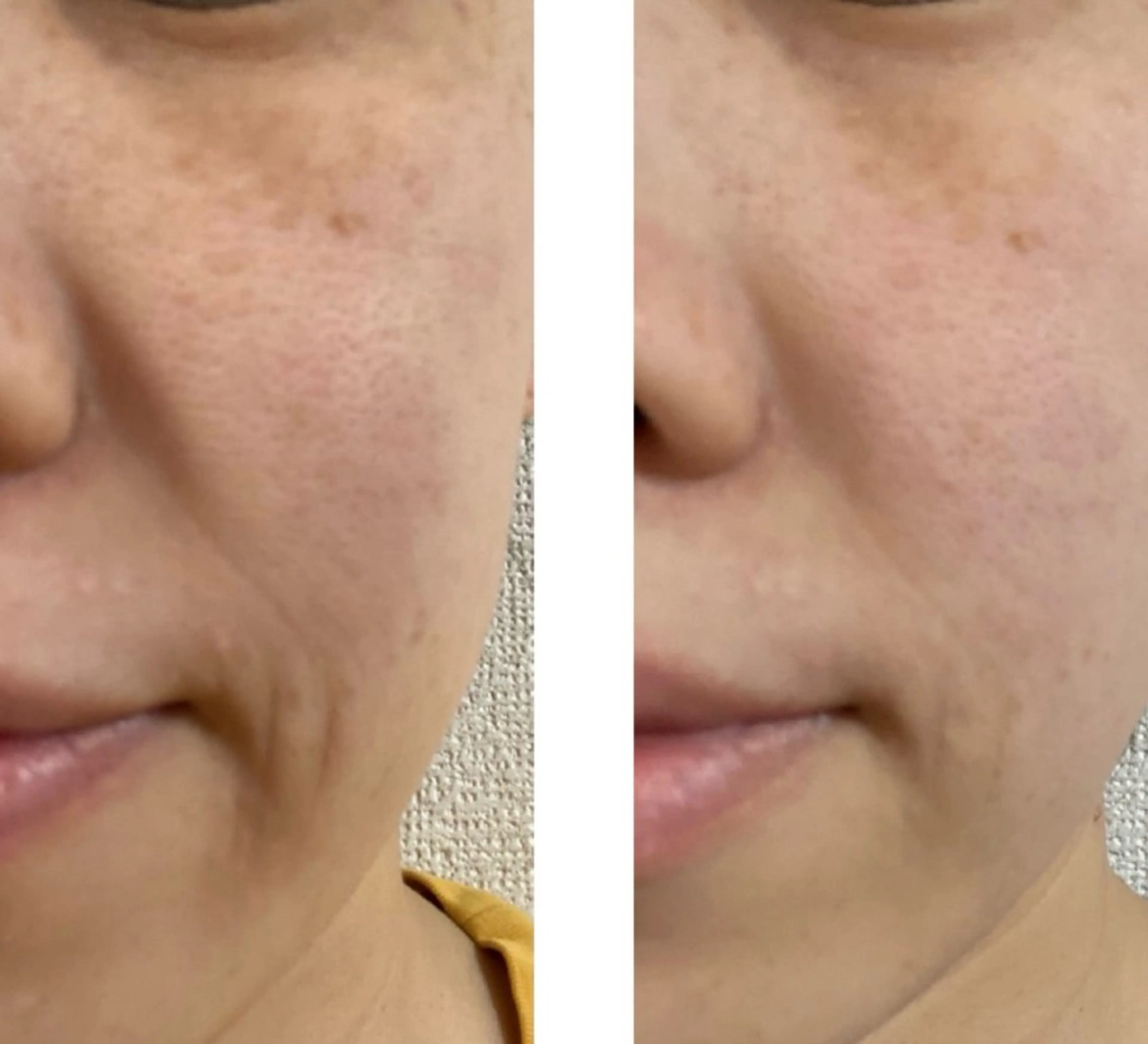 sakura room久我石原のエステ・リラクイメージ