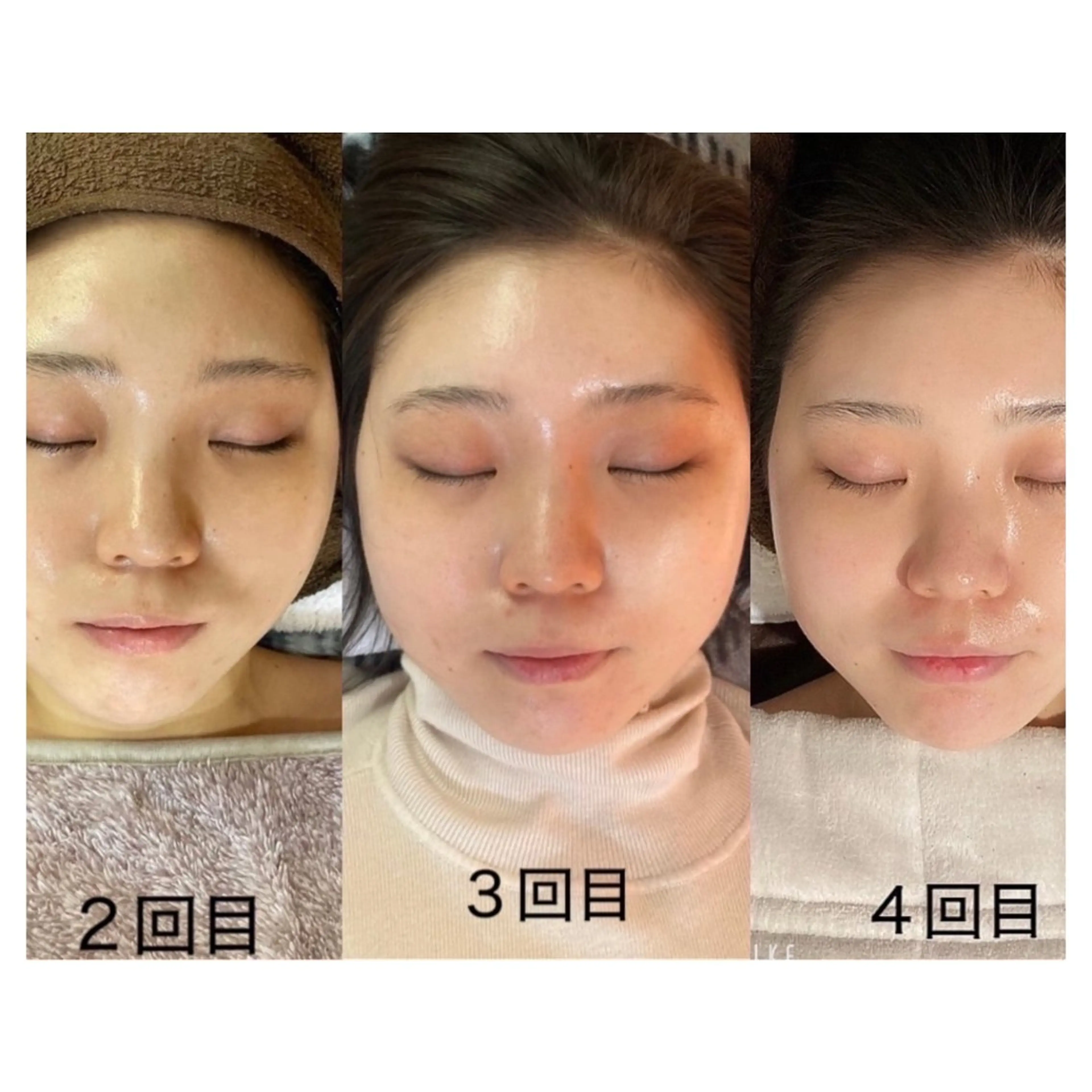 NiU.BEAUTY 新宿のエステ・リラクイメージ