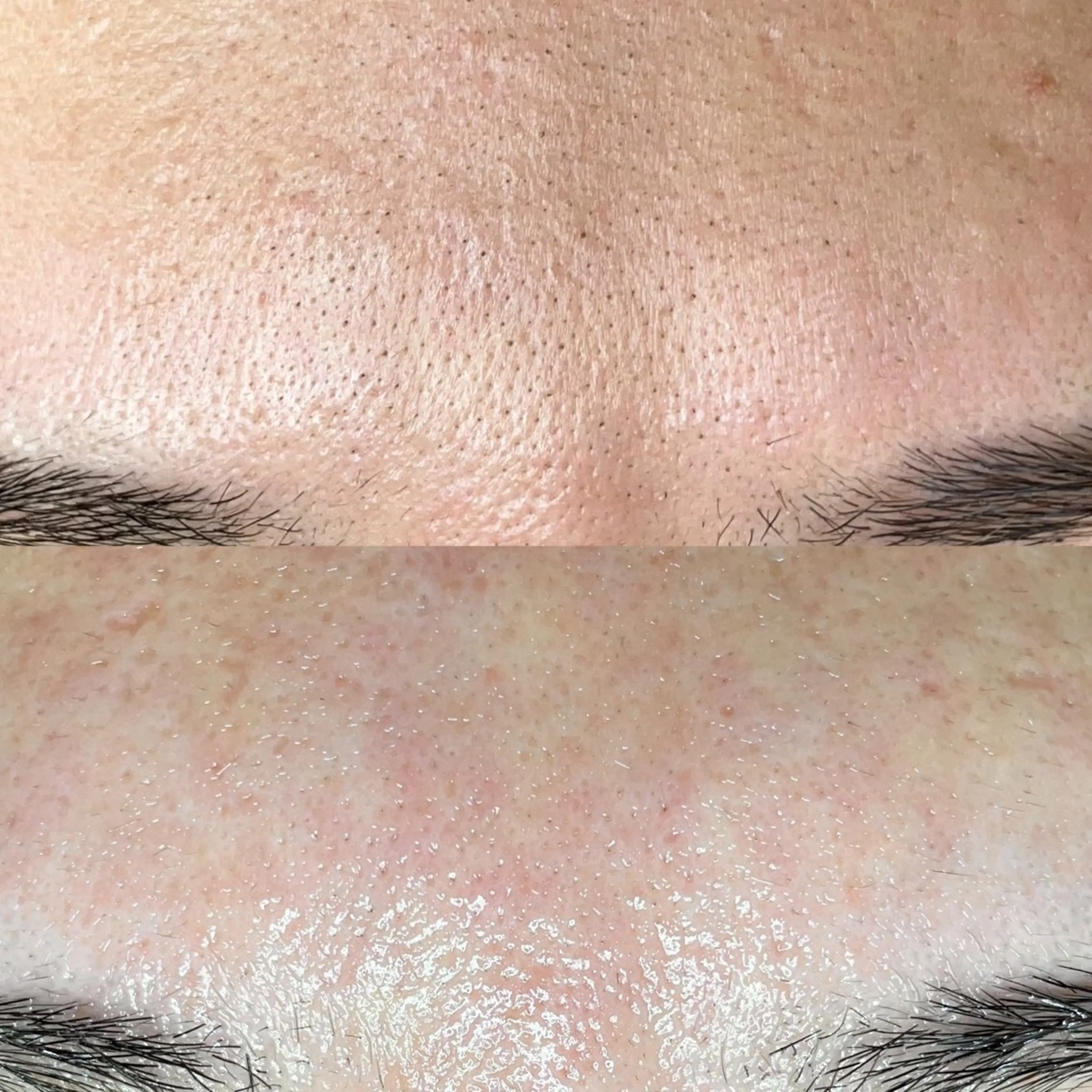 毛穴専門店MeMe.八千代店所属・\毛穴・頭皮/ のお悩みに特化💪のその他イメージ