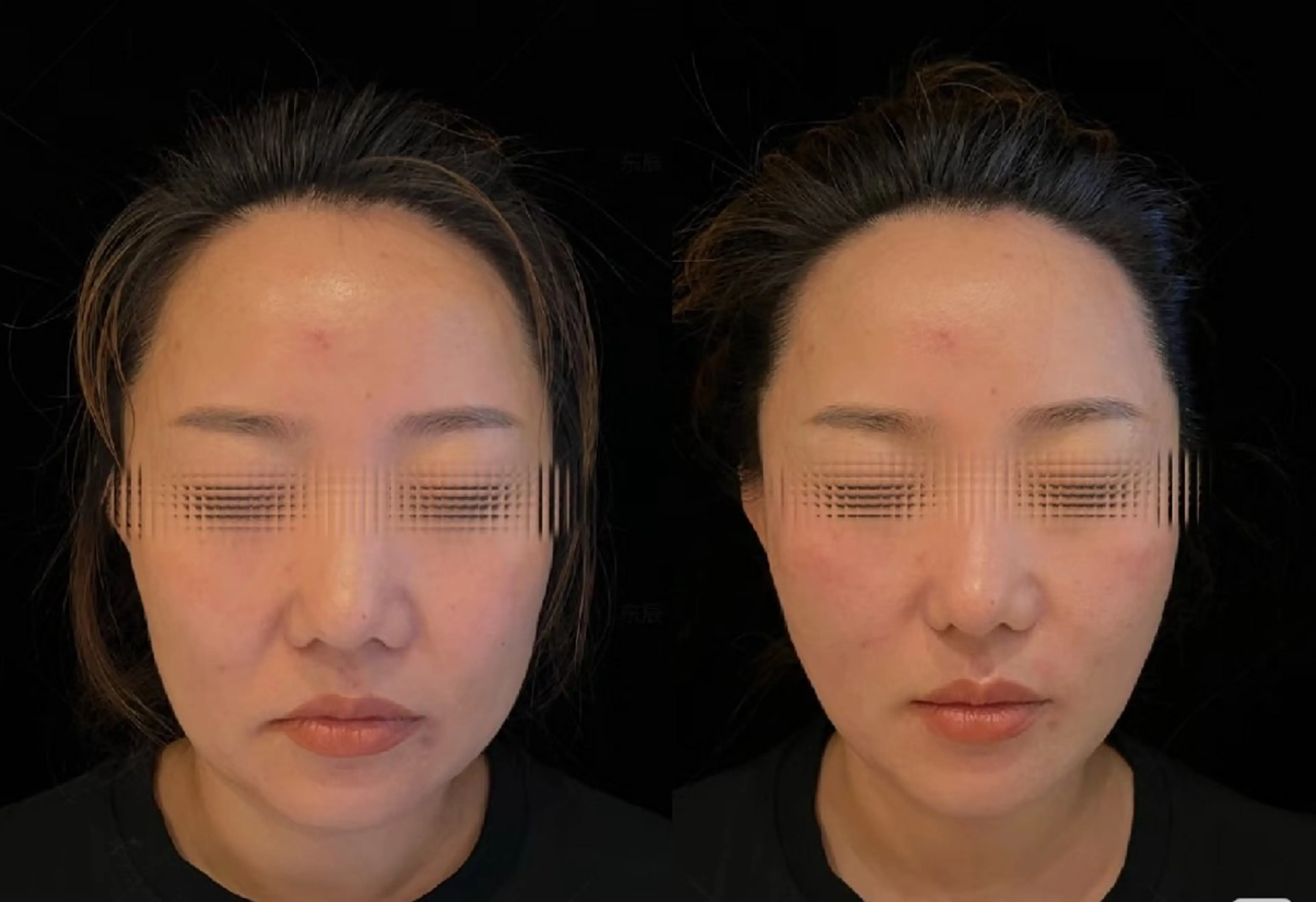 エステ aliaハイフ&水光ジェットサロン所属・aliaハーブ水光店 エステティシャン募集のエステ・リラクイメージ